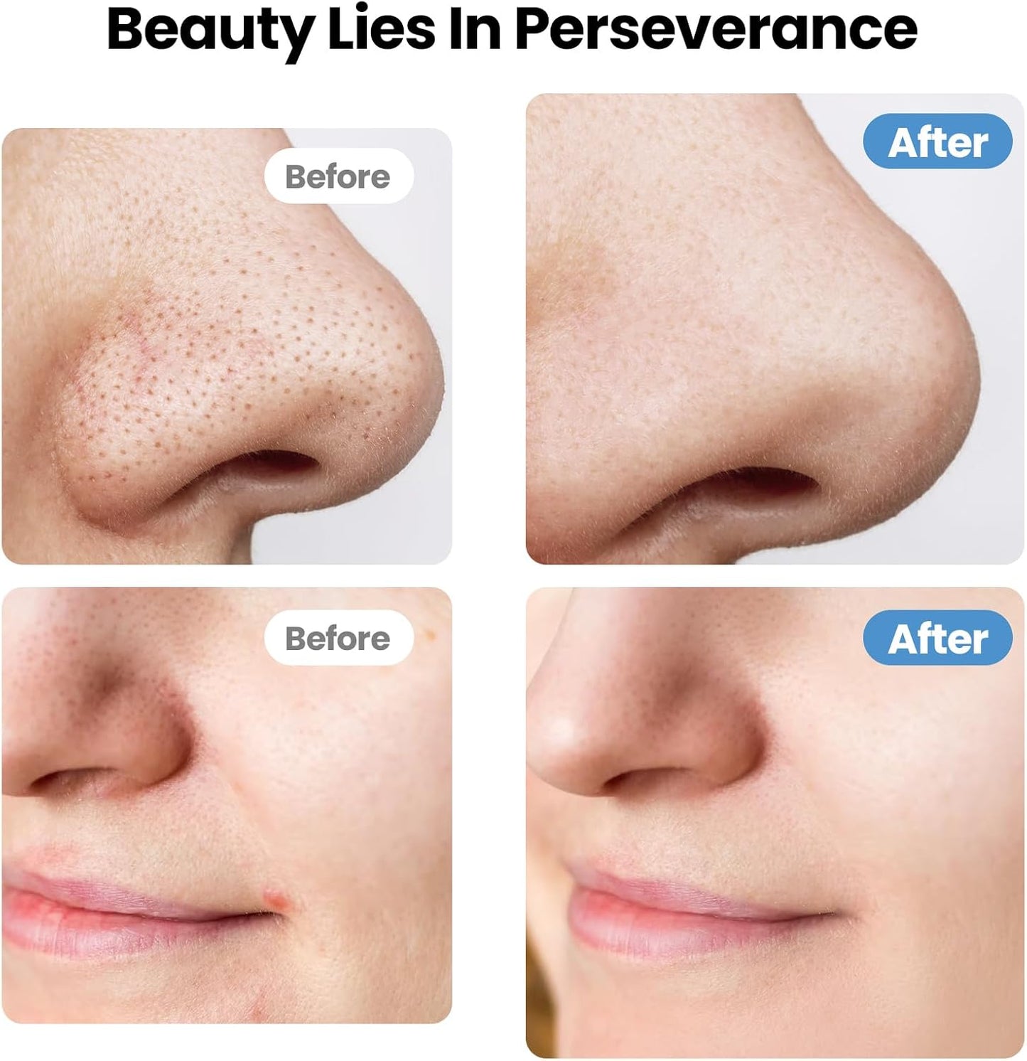 UNIWA Skin Scrubber Face Spatula, Skin Scrubber Pore Cleaner Blackhead Remover Tool for Deep Facial Cleansing - 4 Modes, Face Spatula with USB Charger, LCD Display, IPX7 Waterproof - White