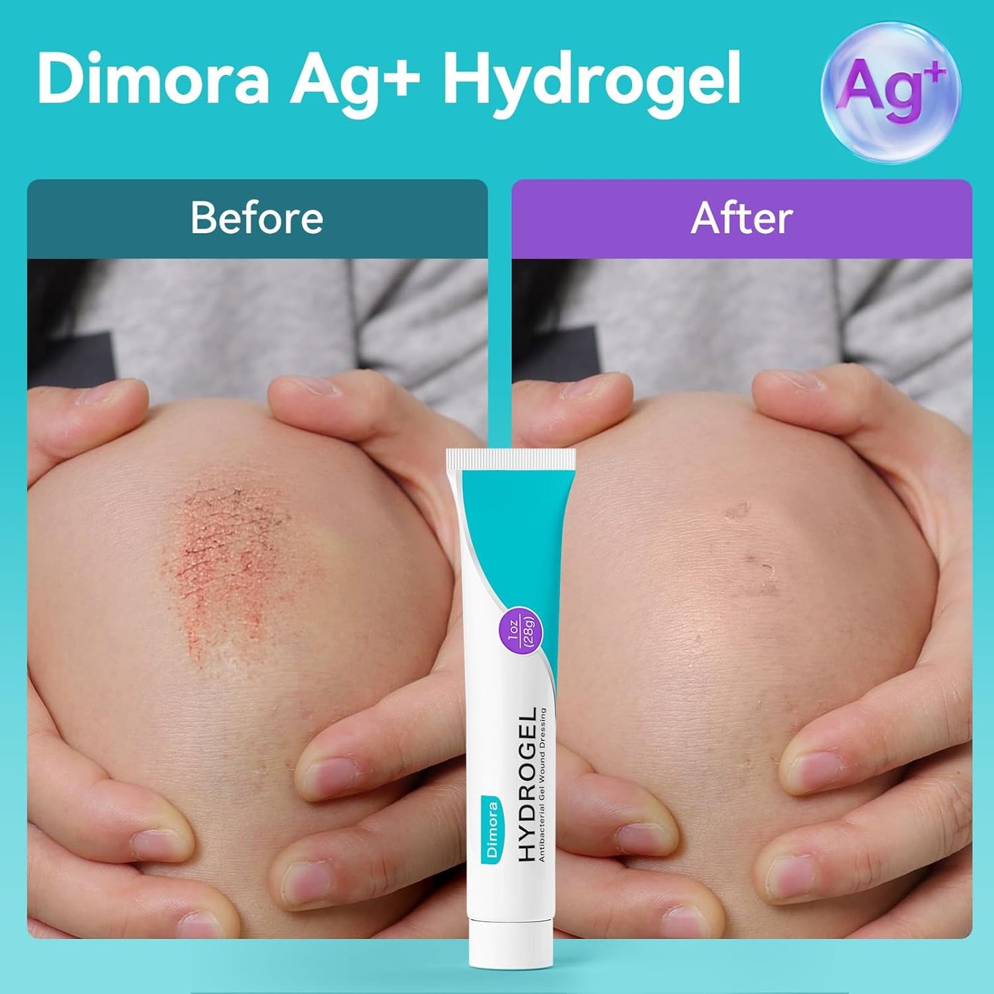 Dimora Antibacterial Gel Wound Dressing-3 Packs 3oz (28gx3), Silver Hydrogel First Aid Ointment for Soothing & Wound Healing, Antibacterial Care for Minor Abrasions, Cuts, Lacerations and Scalds.