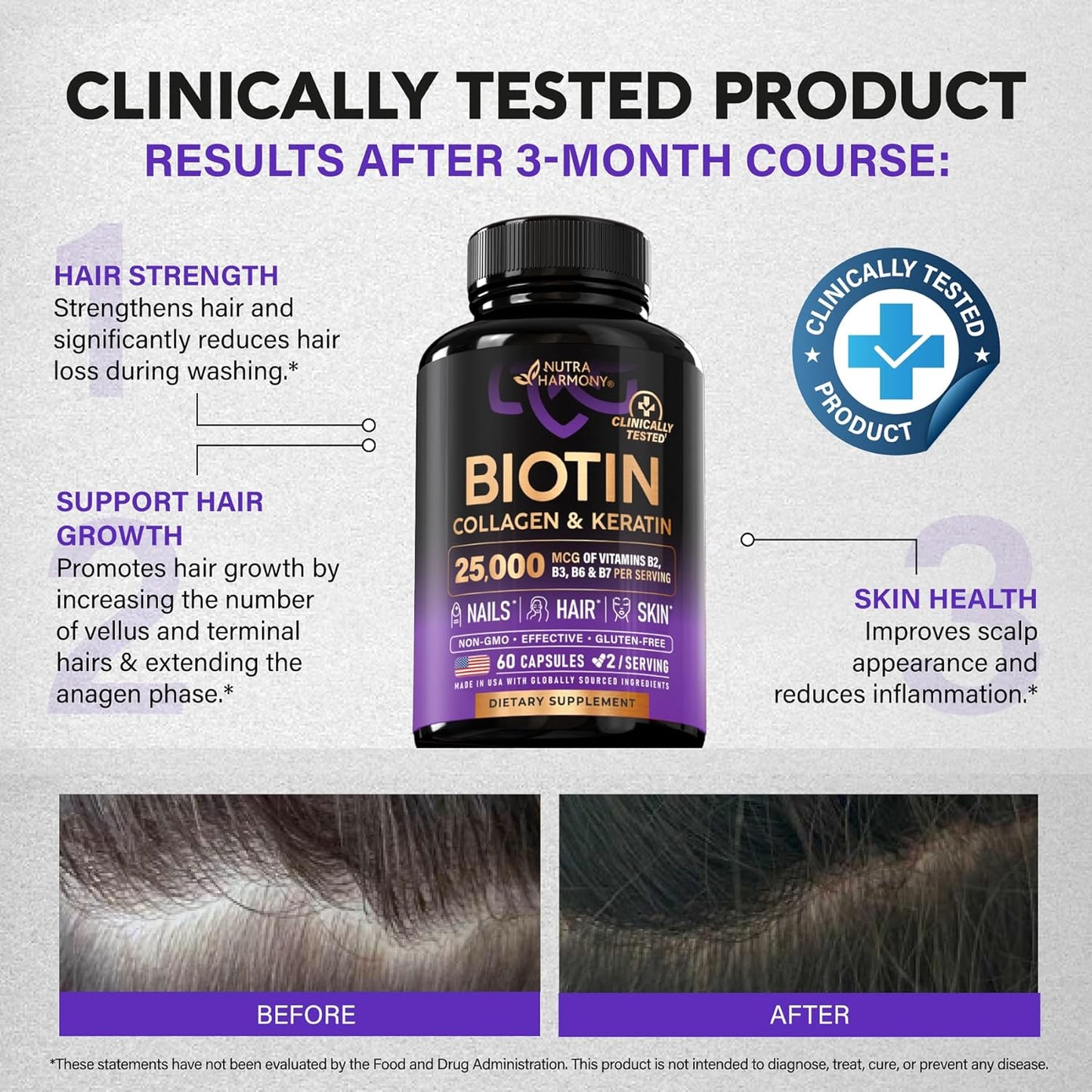 Biotin | Collagen | Hyaluronic Acid | Keratin - Clinically Tested Supplement - Hair Growth Support, Skin & Nails - 25000 mcg Vitamins B2, B3, B6 & B7 + B1 - Made in USA - Women & Men | 60 Capsules