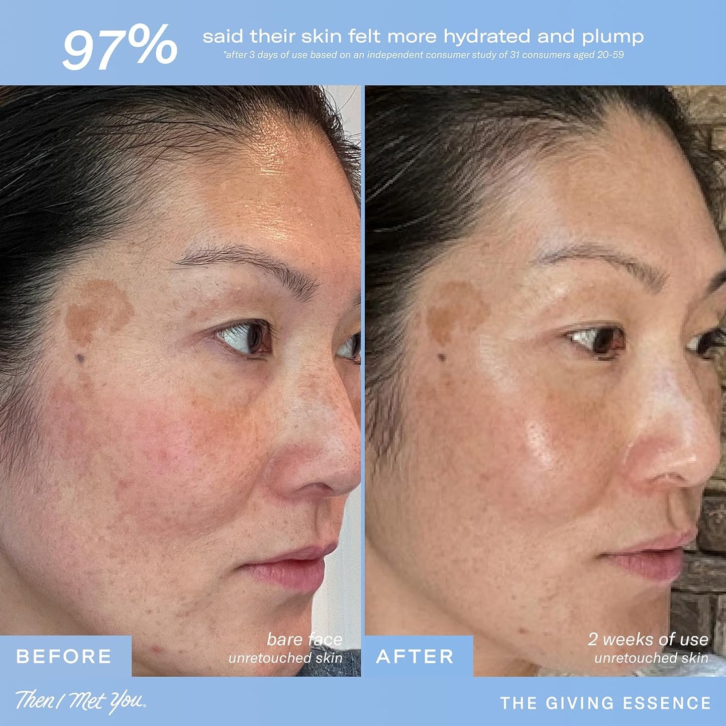 Then I Met You The Giving Essence, Hydrating and Brightening Face Treatment with Niacinamide & Fermented Ingredients, Vegan & Clean Skincare, 5.07 oz