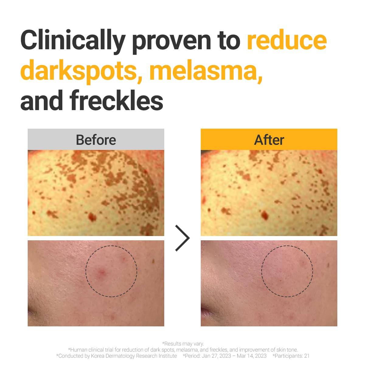 ROVECTIN Vita Dark Spot Serum for Clearing Blemish and Evening Skin Tone | Rich Vitamin C, Brightening, Hydrating For Dry, Sensitive, Normal, Oily Skin | Vegan K-Beauty (1.01 Fl. Oz, 30ml)