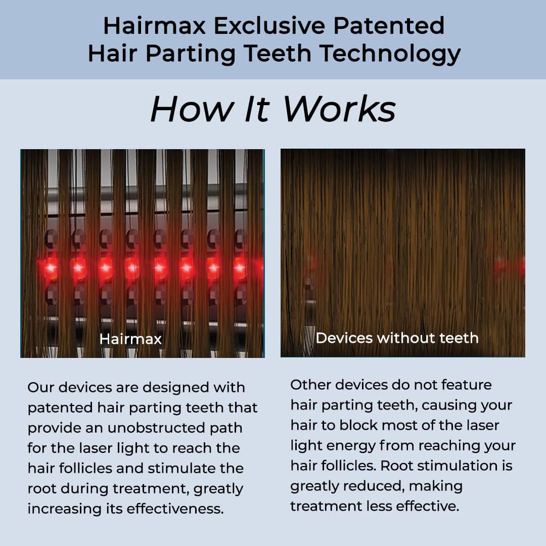 Hairmax Ultima 12 LaserComb - (FDA Cleared) Laser Hair Regrowth Treatment Device for Men & Women - Reverses Thinning Hair Loss - Red Light Therapy to Stimulate Hair Growth - Cordless Design