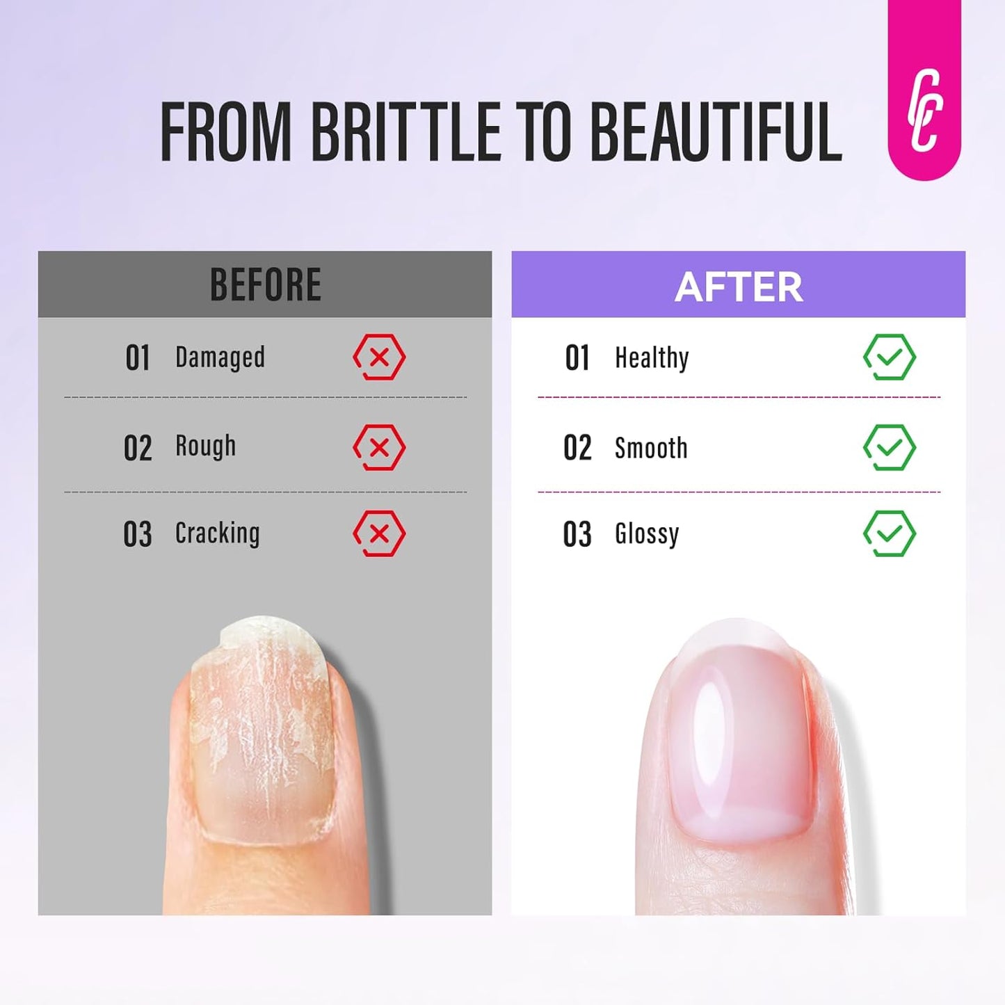 CHUCHU Nail Strengthener and Repair Kit: Pink Hardener and Growth & Cuticle Softener Set - Protein Ridge Filler Polish Quick Dry for Weak Peeling Brittle Splitting Nails - for Women Home Salon