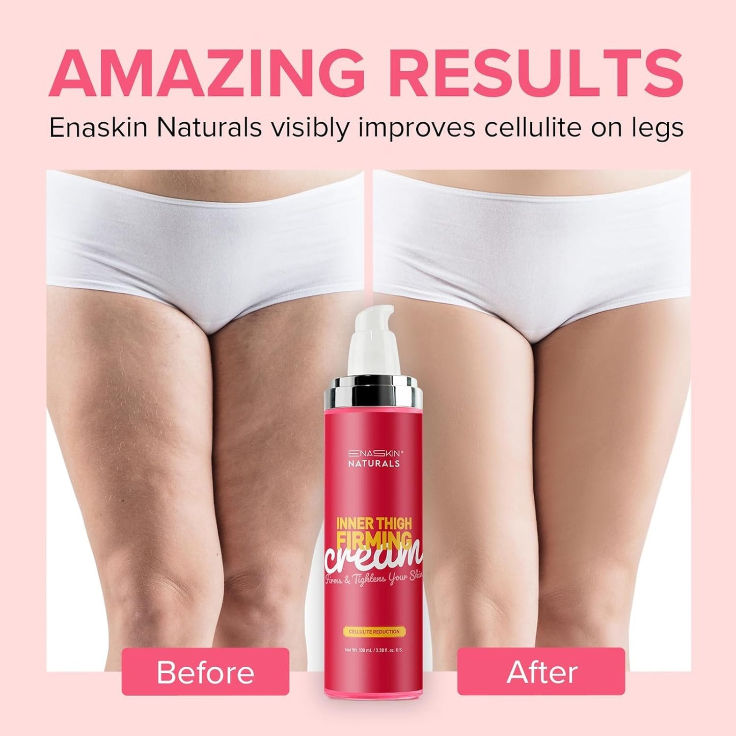 Enaskin Naturals Cellulite Remover for Legs & Anti Cellulite Cream - Skin Firming and Tightening Lotion for Inner Thigh ,Booty, Stomach & Belly, Body Firming Cream for Loose Skin, 100 ML