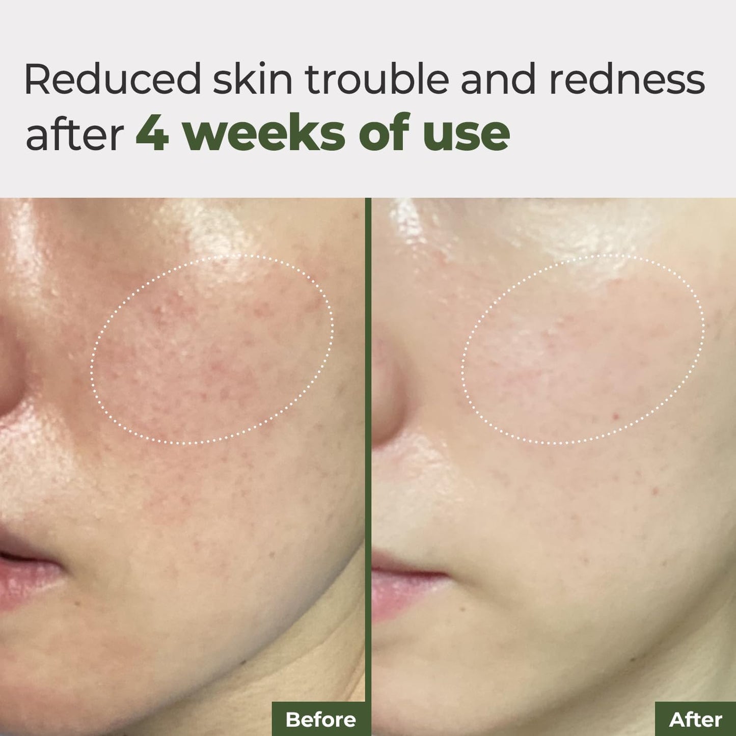 Daily Ampoule Pad – Centella Asiatica Infused Toner Sheets with Antioxidant Deep Nourishing Plant Extracts and Separate Ampoule Pouch for Skin Radiance – (100 Pads)