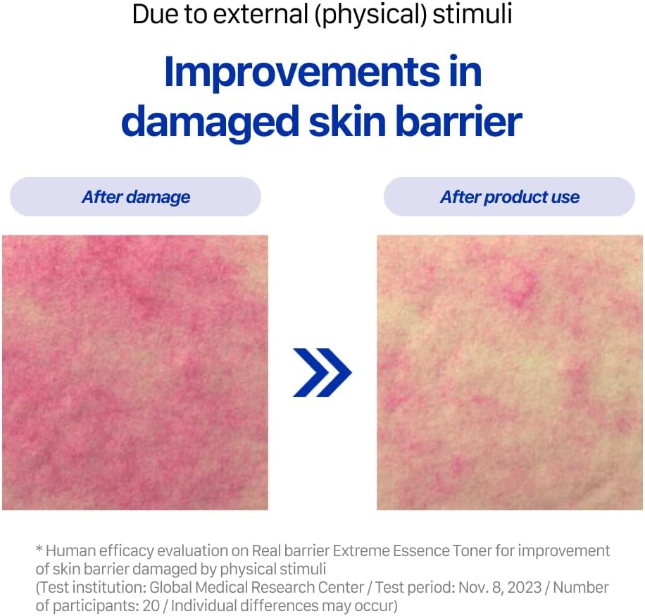 Real Barrier | Extreme Essence Toner | Hyaluronic Acid Panthenol Ceramide Face Moisturizer for Sensitive Dry Skin | Soothing & Hydrating Moisturizing Toner Face | Korean Skin Care | 6.76 fl oz (200ml)