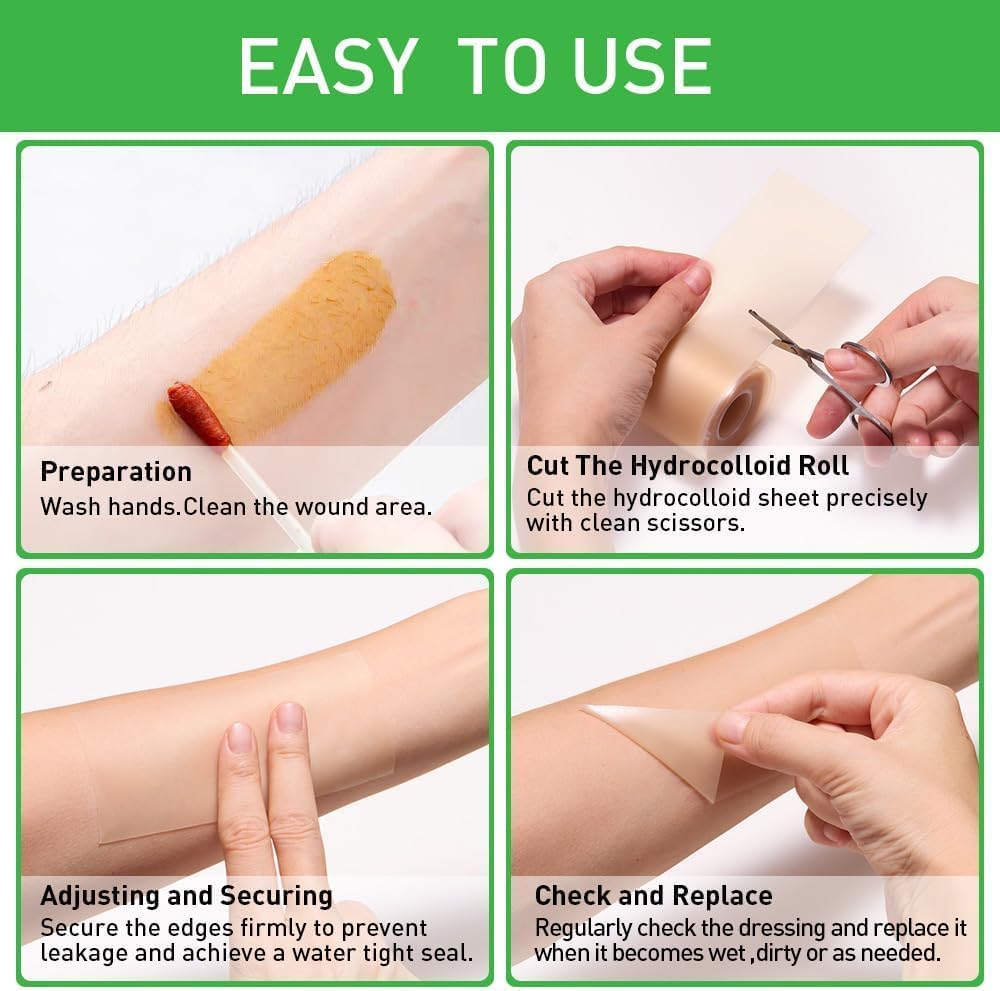 Hydrocolloid Roll for Wound Care, Large Hydrocolloid Bandages Patch with Self-Adhesive Waterproof Ultra Absorbent Flexible DIY Size & Shape First Aid Kit Essential (2in*5ft)