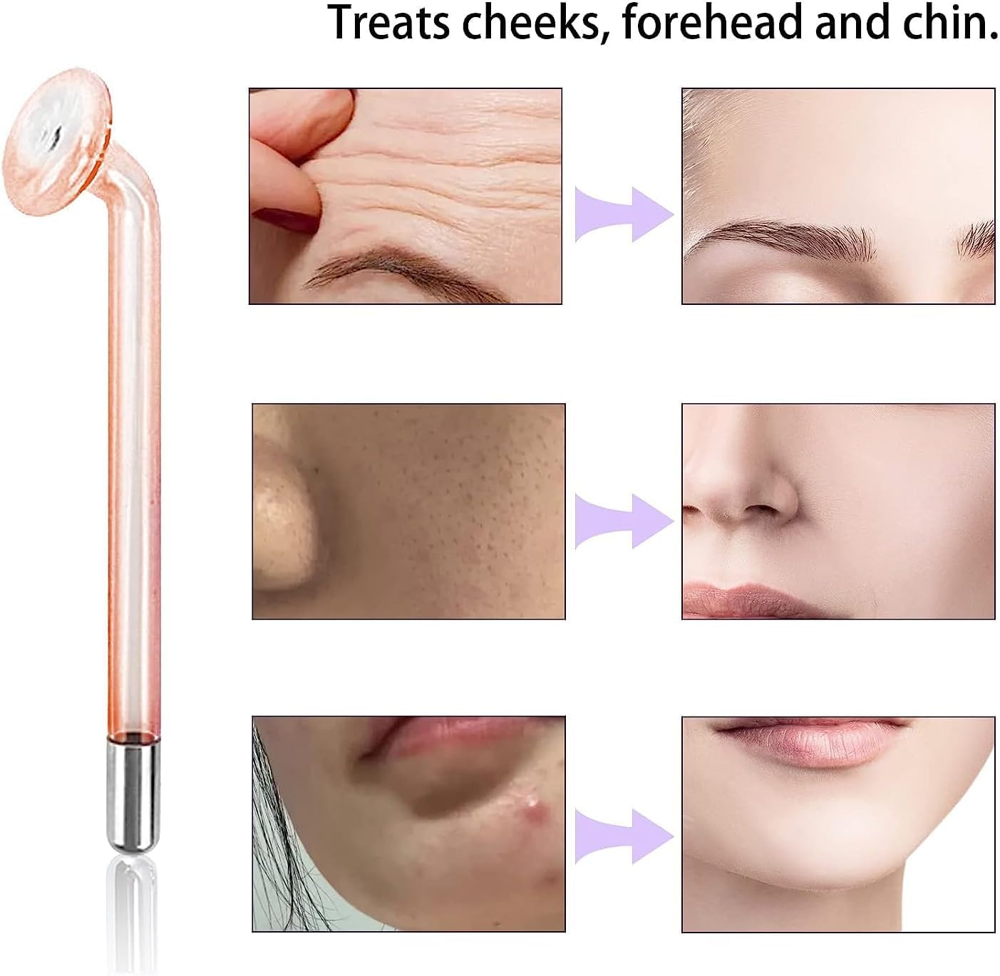 Electrode Wand Glass Tube Handheld Spare Parts for Hi Frequency Instrument Elitzia ETJX006AS (Orange Mushroom)