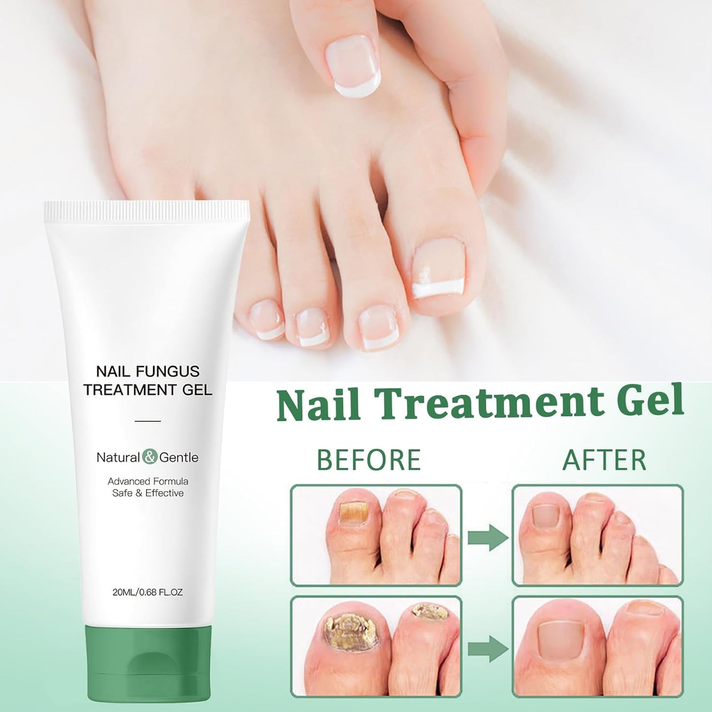 Nutraboost Nail Treatment Gel, Nail Growth Serum for Repair & Strengthener, Multi-Purpose Nail Repair Serum (3)