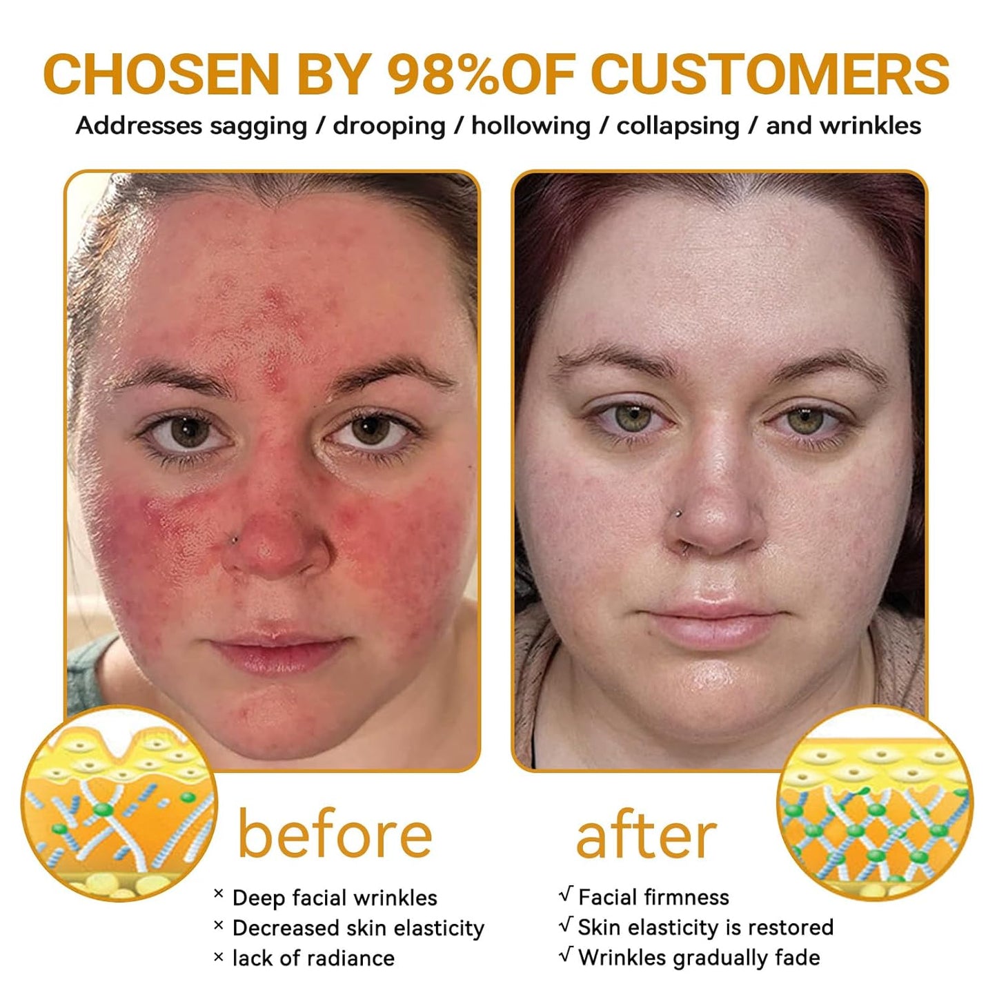 LipMaps Bee Venom Skin Restoration Cream, Bee Venom Skin Treatment Cream, Repair skin and Firming, Effective In Reducing Blemishes (1)