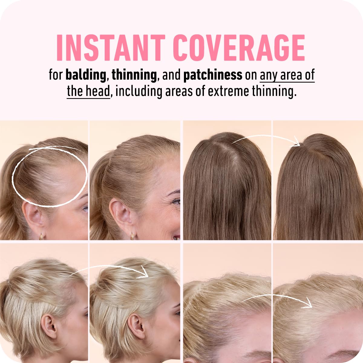 BOLDIFY Hairline Powder (LARGE, 10g) - Root Touch Up Hair Color for Gray Coverage - Bald Spot Concealing Hair Powder for Women & Men - 48-Hour Stain-Proof - White