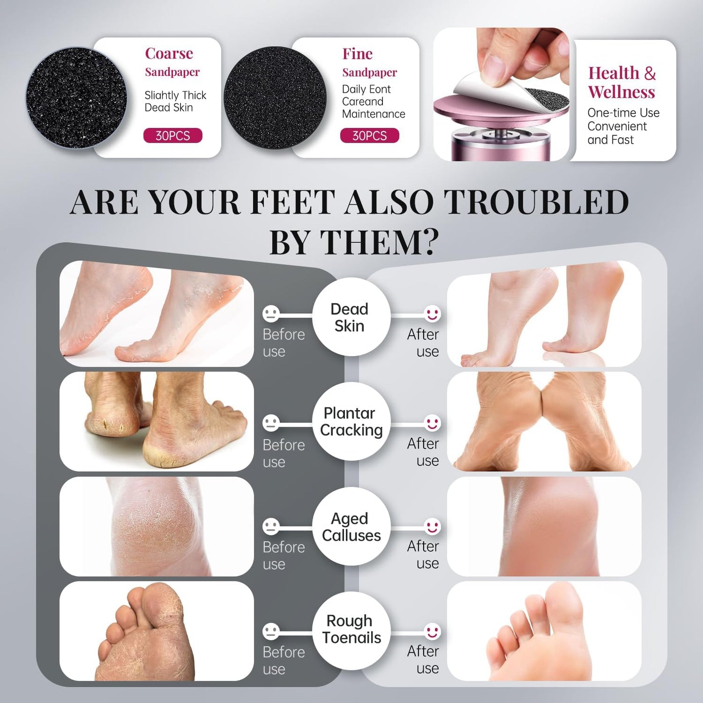 krofaue Electric Foot File Remover Callus - Professional Aluminum File Grinder Adjustable Pedicure Tools with 60pcs Sandpaper Disks for Dead Skin