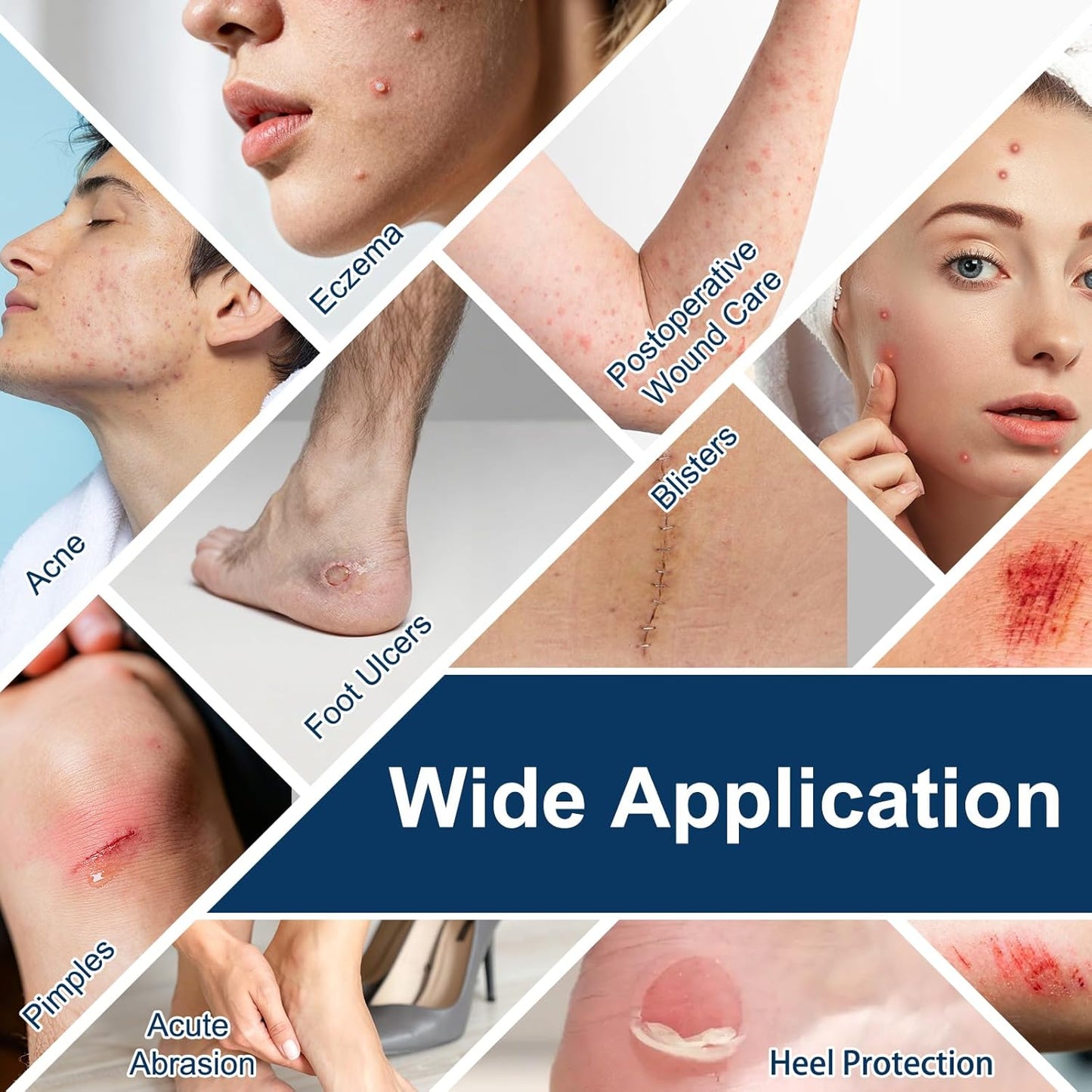 Hydrocolloid Roll for Wound Care - Extra Large Hydrocolloid Patch Bandages with Self-Adhesive, Ultra Absorbent, Flexible & Waterproof, First Aid Kit Essential (2in*16ft)