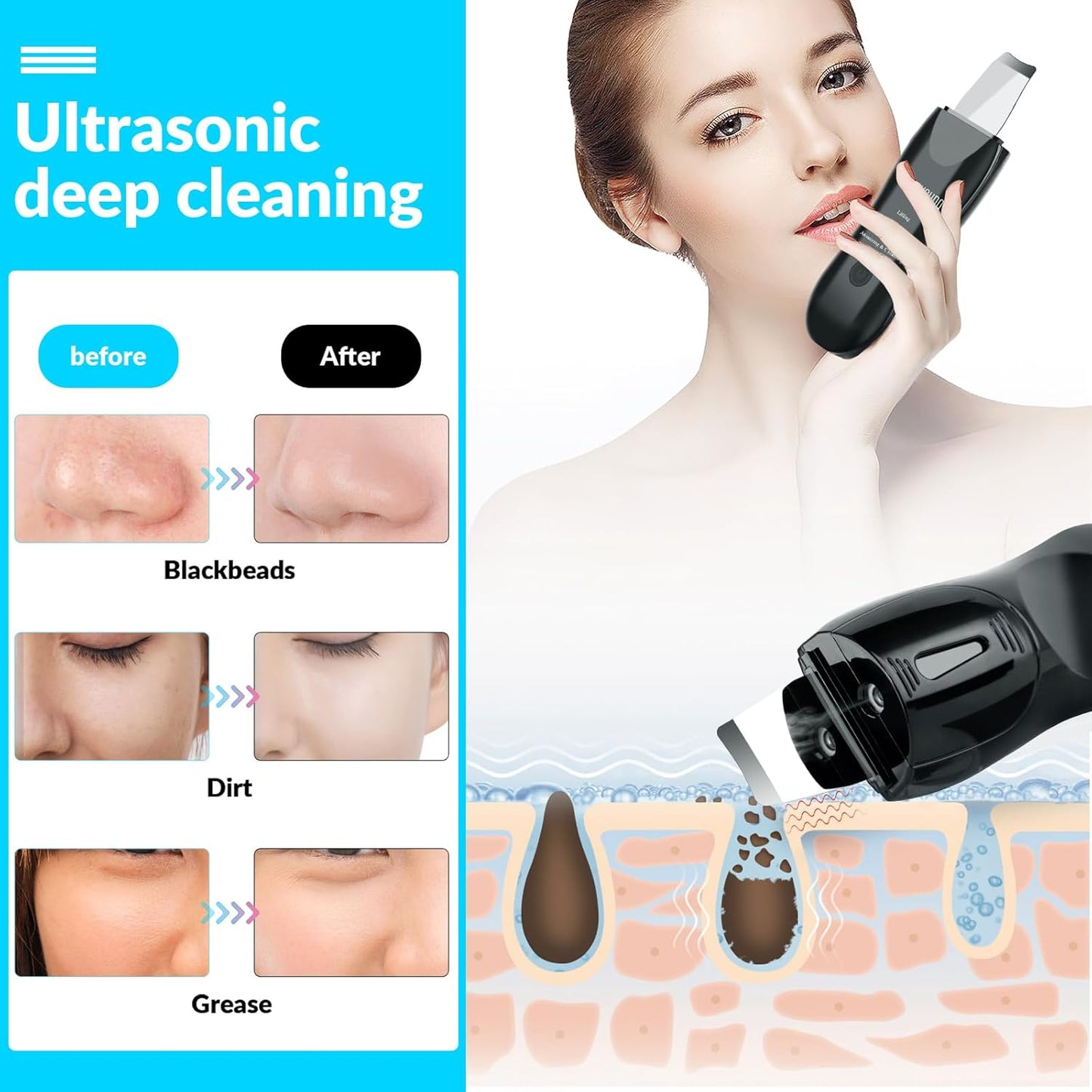 Facial Skin Cleanser with Mister, Upgraded Sprayer, Blackhead Extractor for Deep Cleansing and Moisturizing Spray