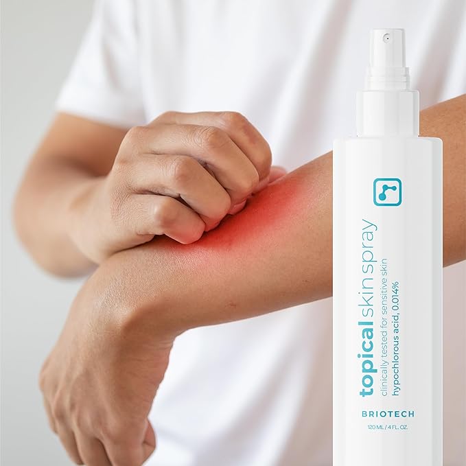 BRIOTECH Topical Skin Spray, Hypochlorous Acid Spray for Sensitive Skin, HOCl Facial Mist, Full Body Support Against Irritation, Calm Redness, Soothe Foot & Scalp, Travel Size 2 oz (2 Pack)