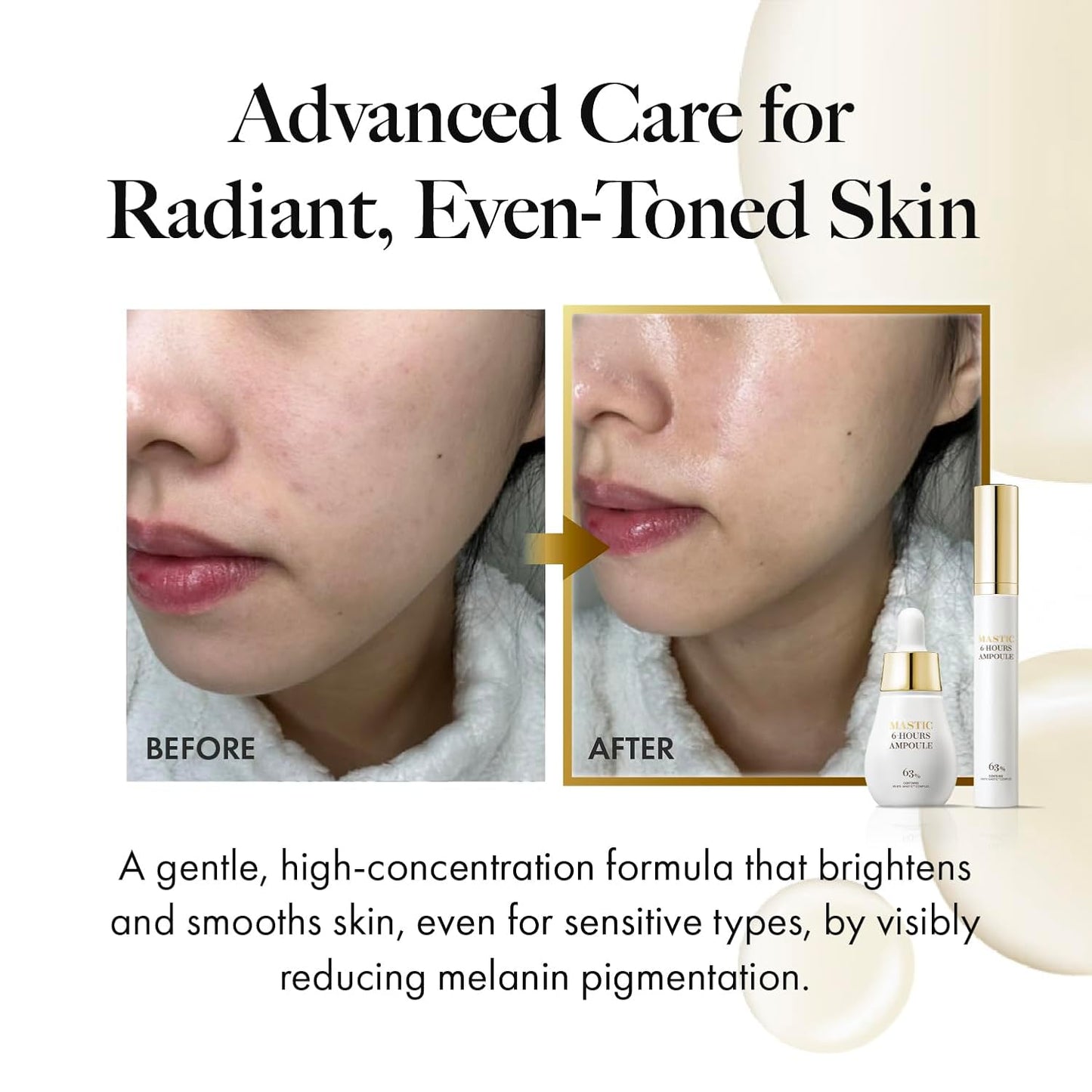 MASTINA Mastic Serum Roller - Dark Circle Remover & Eye Serum for Brighter, Firmer Under Eyes, Korean Skin Care, 0.5 fl oz,White Mastic Complex 63% + Tranexamic Acid 2% + Niacinamide 5%