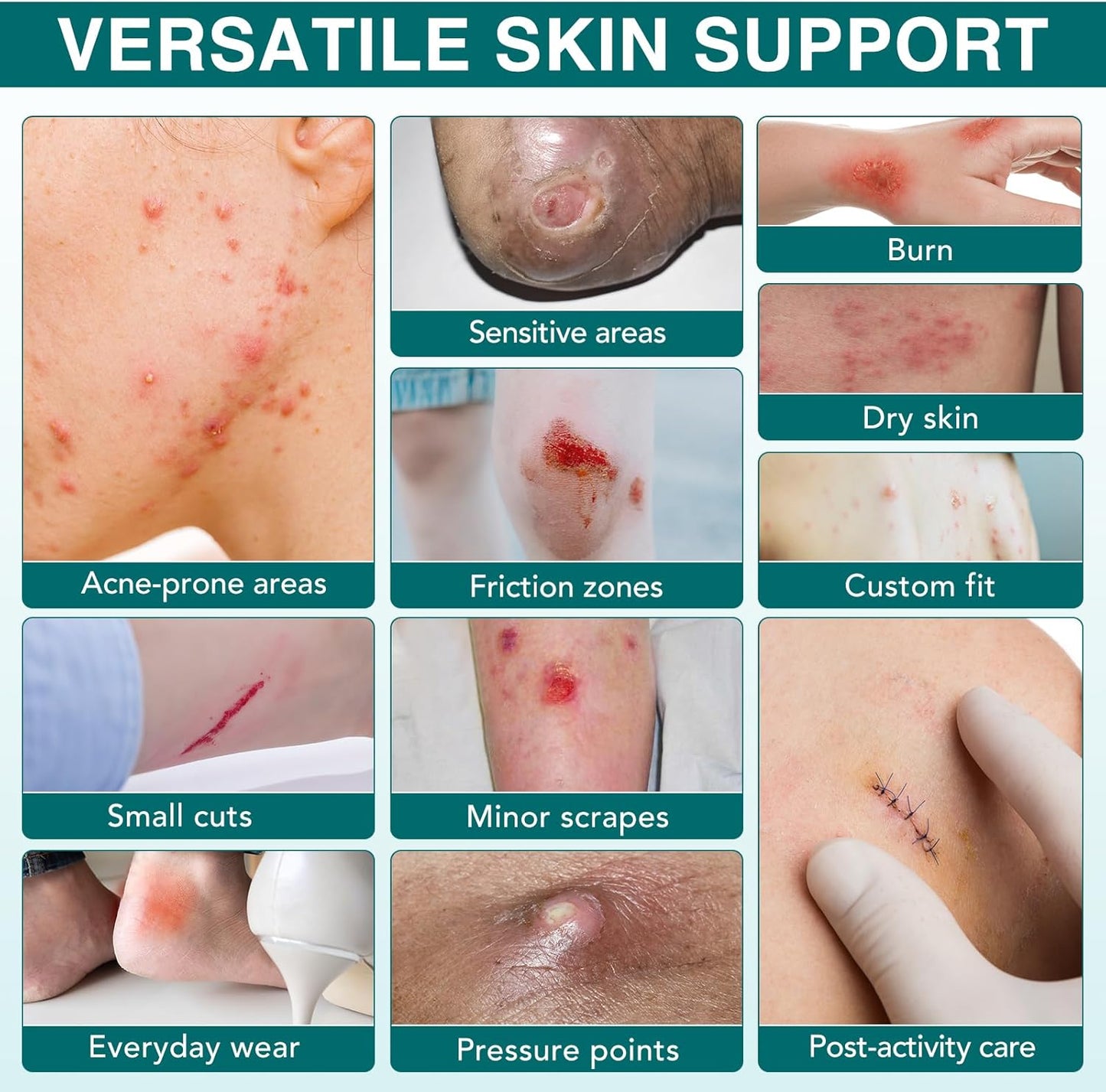 Hydrocolloid Roll for Wound Care, (2in*11.8ft) Hydrocolloid Bandages, Cut-to-Size, Medical Grade Hydrocolloid Roll with Self-Adhesive, Ultra Absorbent, Flexible & Waterproof, First Aid Kit Essential