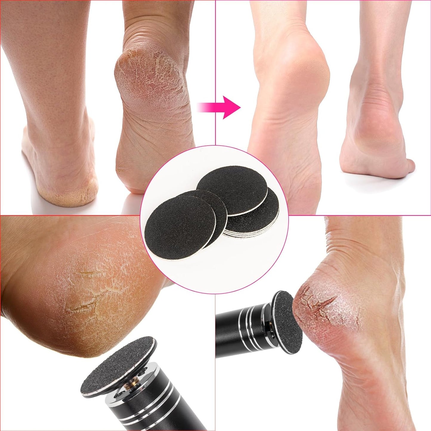 krofaue 60 PCS Replaceable Sandpaper Discs - 80 & 100 Grit Pad Refills for Electric Foot File Callus Remover - Dead Skin and Calluses Removal