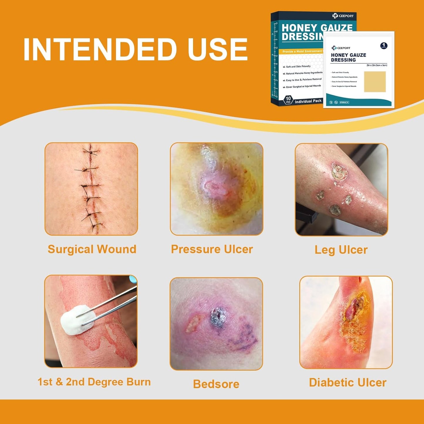 Manuka Honey Gauze Wound Dressing 2" x 2",10 Pack Manuka Honey Wound Care Pads, Medical Grade Honey Bandages for Wound Care, Honey Patch for Faster Healing from Burns,Abrasions,Cuts and Scalds