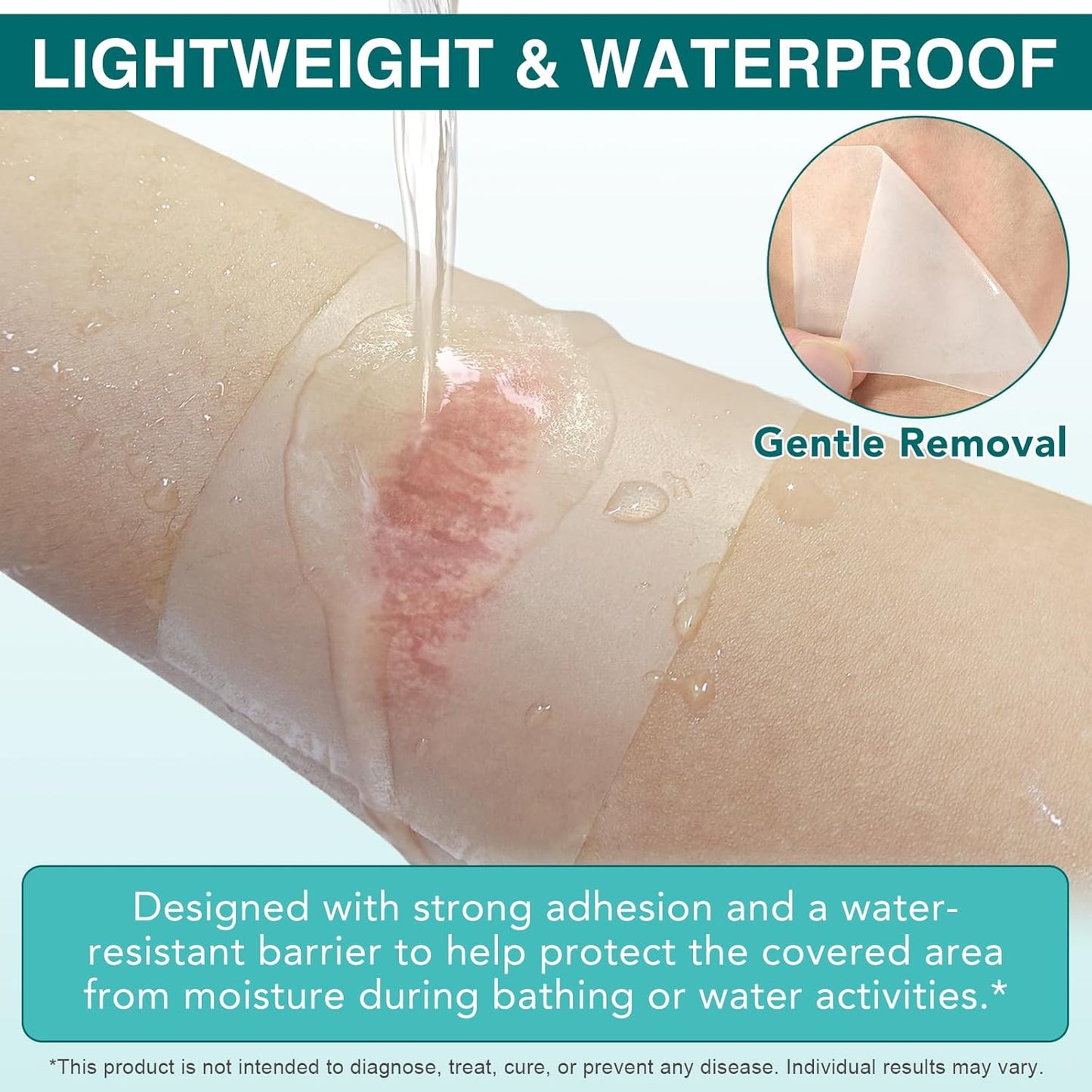 Hydrocolloid Roll for Skin Care,Cuttable Hydrocolloid Patch Bandages(2in*11.8ft),Hydrocolloid Roll with Self-Adhesive, Ultra Absorbent, Flexible & Waterproof