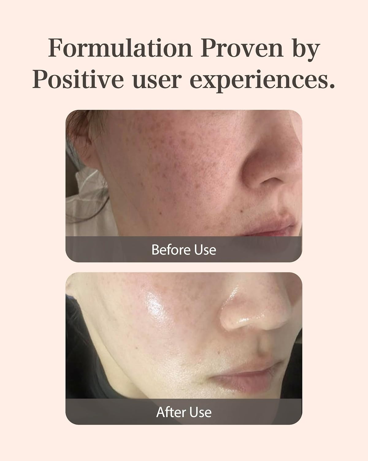 MASTINA Mastic Ampoule Serum Dropper Type (0.5fl oz, Pack of 2) White Mastic Complex 63%, Tranexamic Acid 2%, Niacinamide 5% - Face Serum for Firming, Hydrating, Radiant Glass Skin. Korean Skin Care