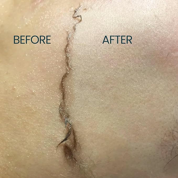 Dermaplane Oil for Combination Skin - Shave Oil for Women, Face Shaving Oil for Women, Use with a Dermaplaning Tool, Razor, Shaver or Microblade for Close Shave 2 oz by Ouiloe