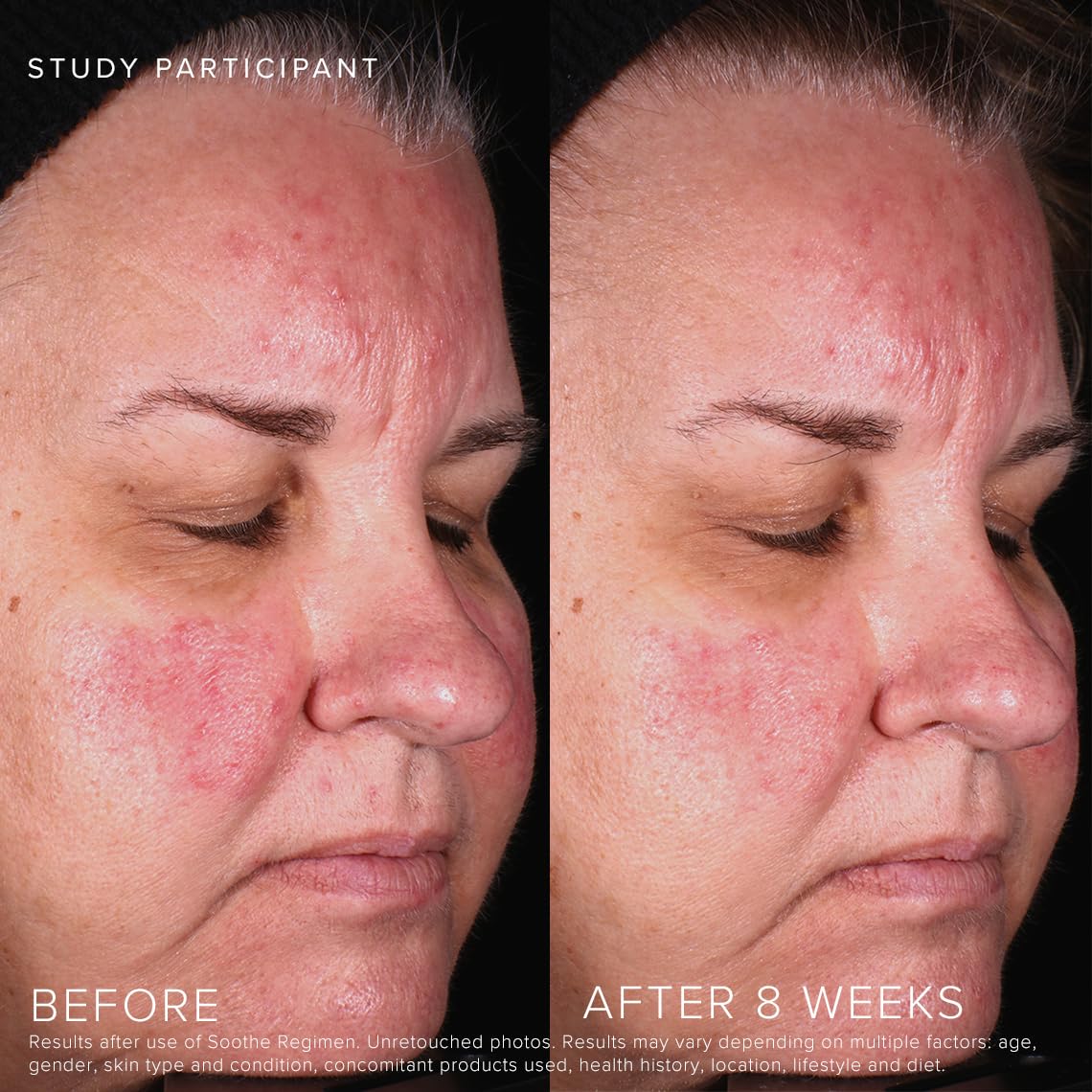 Rodan + Fields Soothe Calming Gel Cleanser | 125 ml | Dry & Sensitive Skin | Moisturizing & Hydrating Skincare