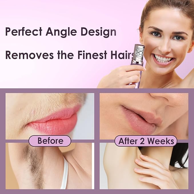 Gurelax Hair Removal Epilator for Women, Rechargeable Facial Epilator Hair Remover, 2-in-1 Electric Epilator & Shaver, 18 Carat Gold Plated Head, All Ages and Skin Types