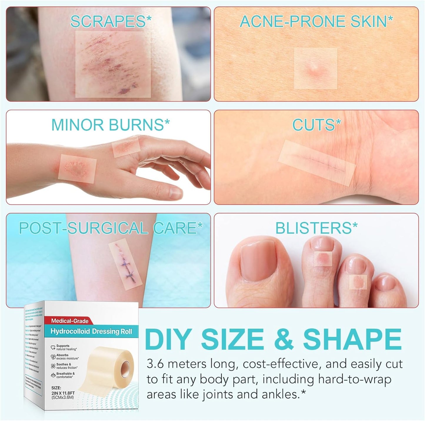 Hydrocolloid Roll for Wound Care, Extra Large Hydrocolloid Patch Bandages with Self-Adhesive, Hydrocolloid Tape, Ultra Absorbent, Flexible & Waterproof DIY Size & Shape(2in*11.8ft)