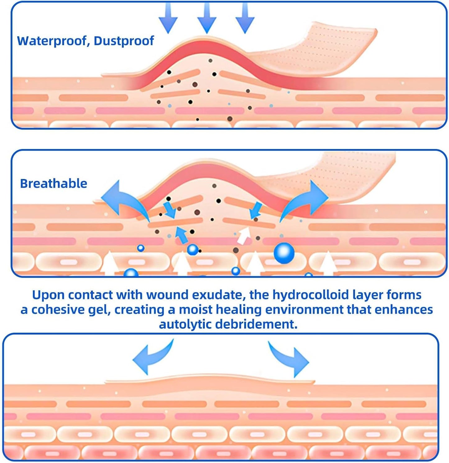 8 Count Hydrocolloid Bandages 4"x8", Large Hydrocolloid Gel Bandages for Wounds, Wound Healing Bed Sore Dressings