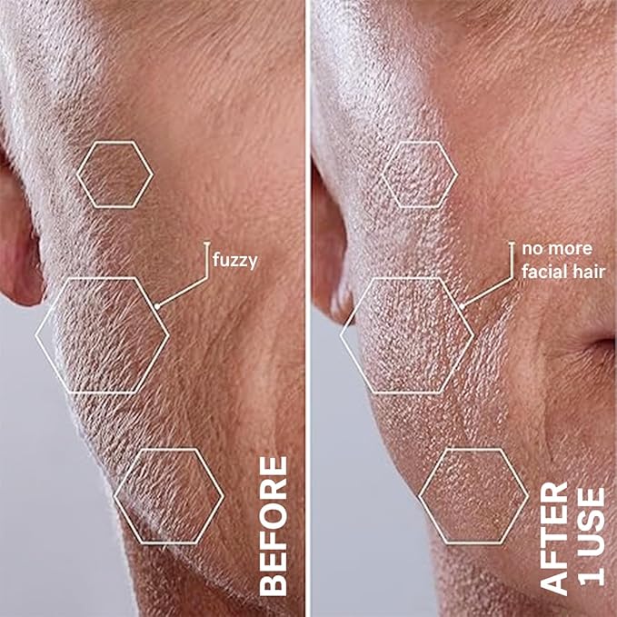 Michael Todd Beauty Sonicsmooth Dermaplane Razor for Women Face + Eyebrow trimmer Dermaplaning System - Peach Fuzz Remover - 8 Weeks of Dermaplaning Blades