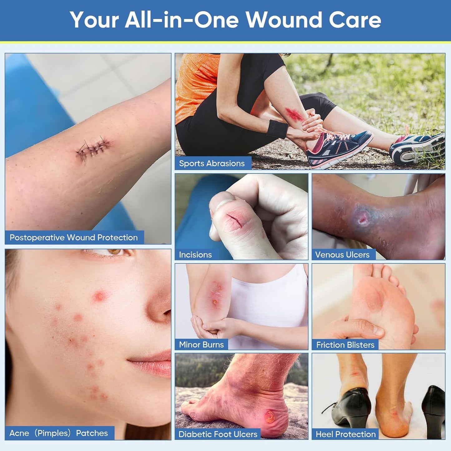 Hydrocolloid Roll for Wound Care, Cut-to-Size, Extra Large Hydrocolloid Tape Patch Bandages with Self-Adhesive, Ultra Absorbent, Flexible & Waterproof, First Aid Kit Essential (2in*12ft)