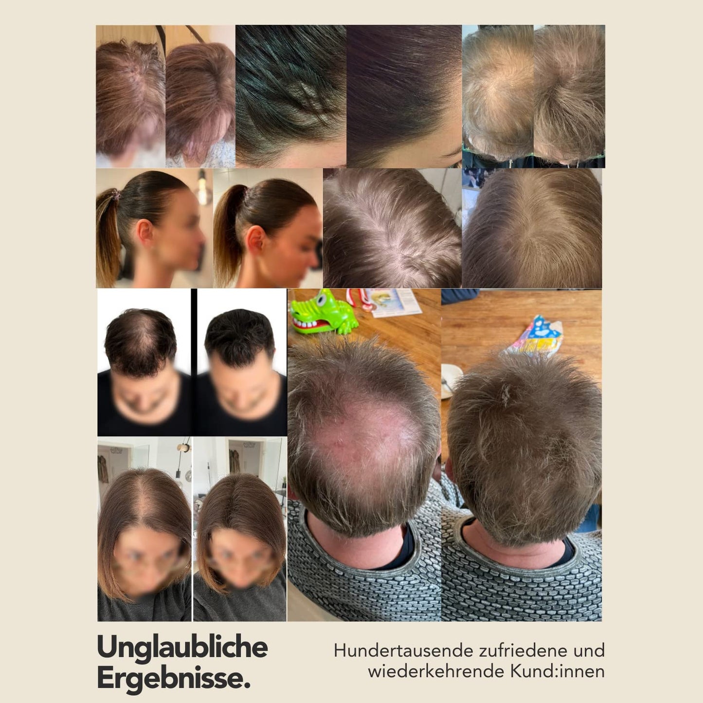 IMPERIO Hair Building Fibers for Thinning Hair - 26g Premium Hair Fibers for Women & Men in Hairdresser Quality - Hair thickening in less than 20 seconds (Dark Blonde)