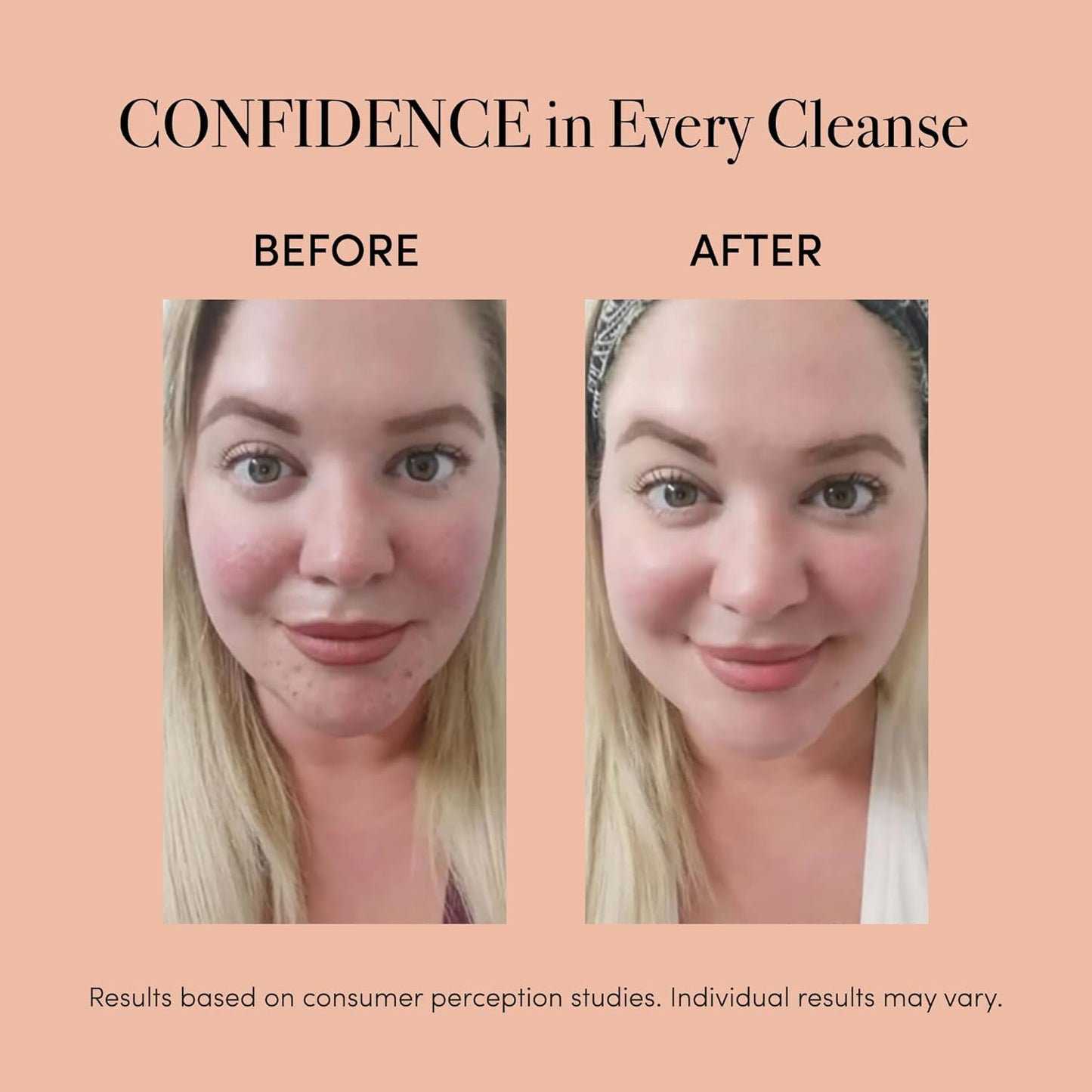 Revive Light Therapy Soniqué Mini Acne Cleanser, Battery-Operated Sonic Face Cleanser Brush with Blue & Red Light Therapy, Medical-Grade Acne Device for Face & Body, Water-Resistant