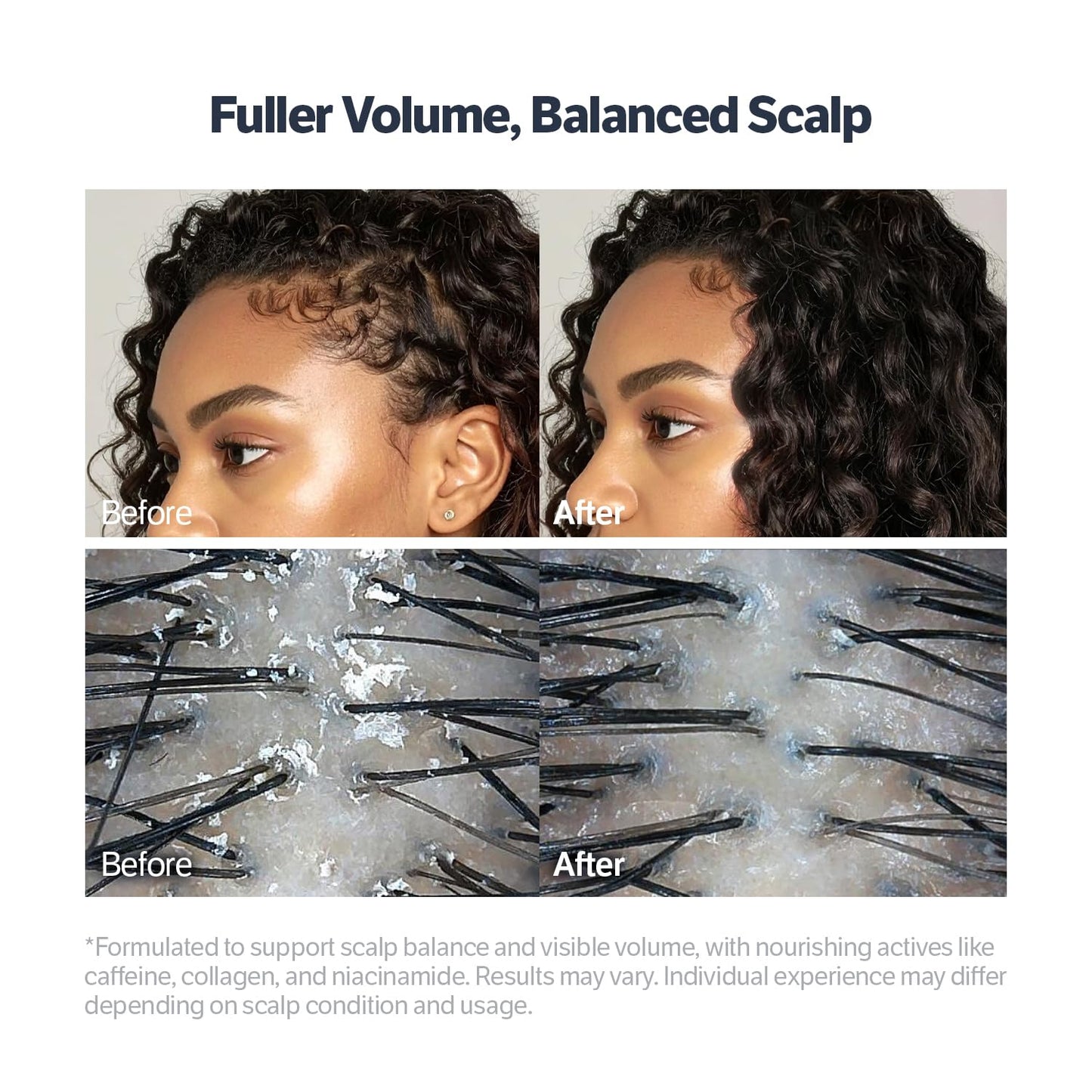 SUNGBOON EDITOR Deep Collagen Retinol Power Boosting Scalp Serum | Roll On Hair Growth, Hair Thickening Serum, Itchy & Dry Scalp Treatment, Caffeine, Biotin, Rosemary – Korean Hair Care, 0.5 fl oz