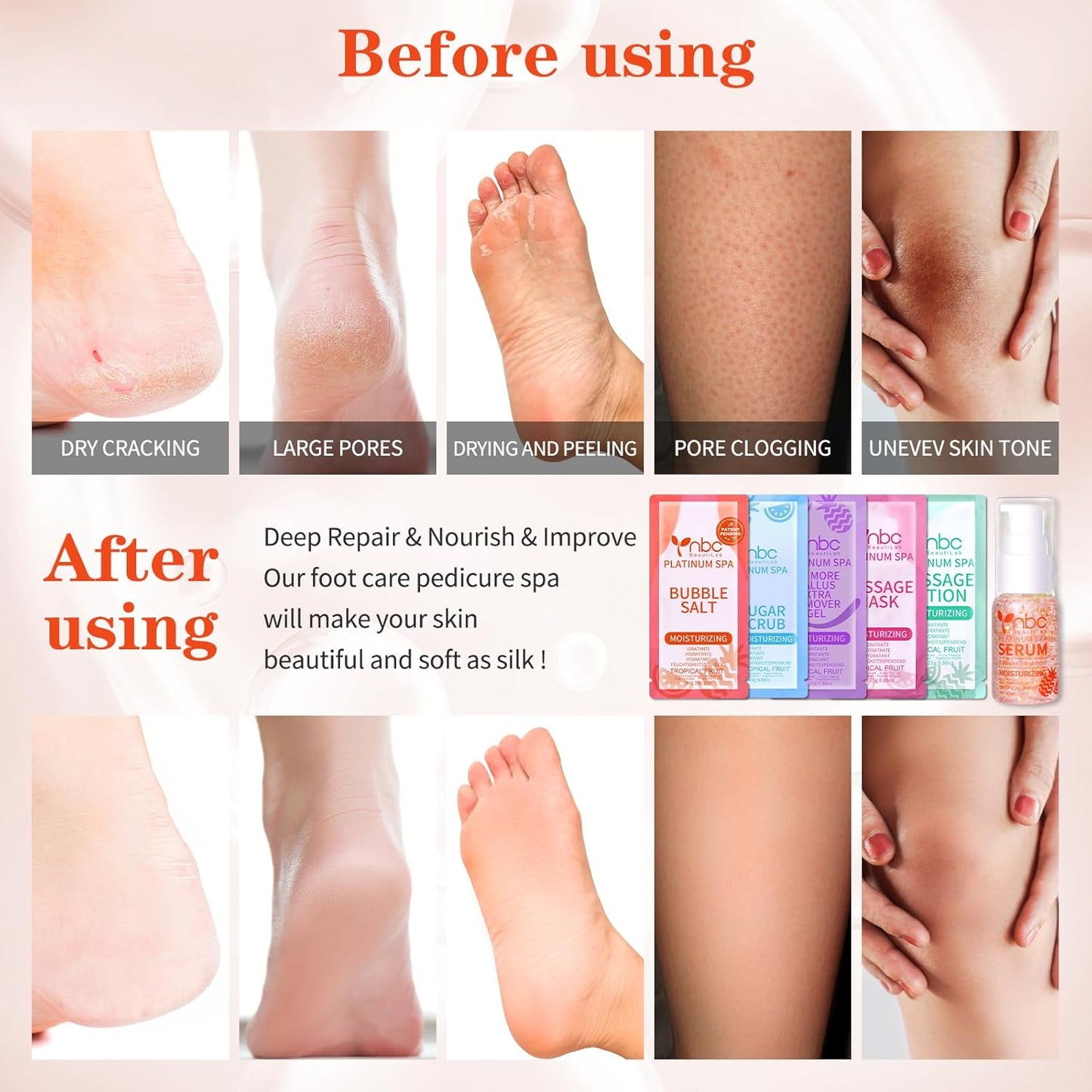 Pedicure Foot Soak Set - Upgraded 6 in 1 Foot Spa, Foot Bath Spa, Pedicure Kit, Foot Soak for Tired & Dry Cracked Feet, Athletes Feet, Bad Odor, Softens Calluses (Tropical fruit)