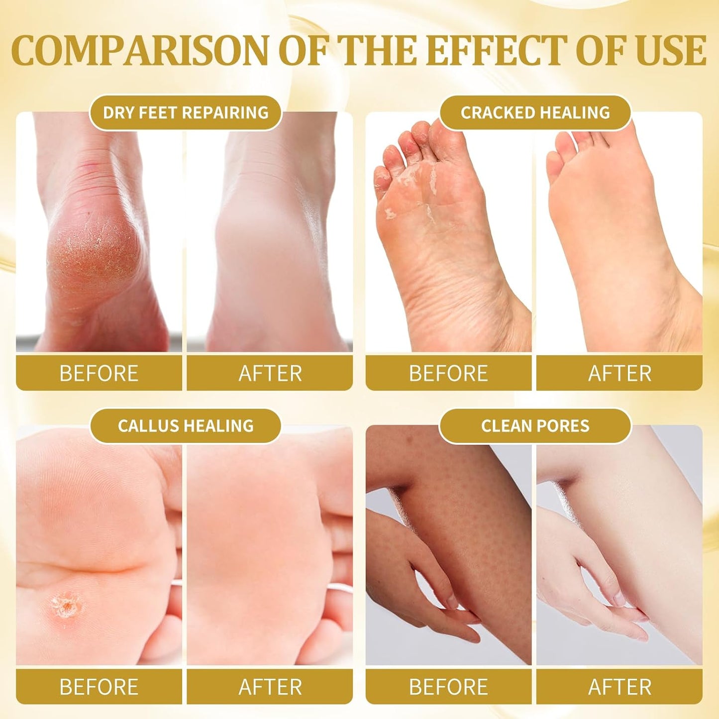 Pedicure Kit Foot Soak Set: Bubble Salt, Sugar Scrub, Massage Mask, Massage Lotion in a Box, 4 Step Foot Spa Kit for Dry Feet, Tired Feet（3 Set Honey flower)