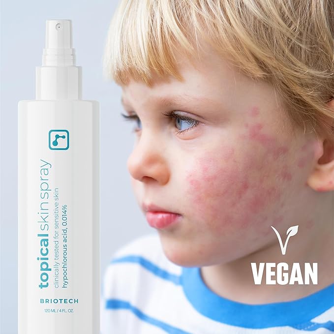 BRIOTECH Topical Skin Spray, Hypochlorous Acid Spray for Body & Face, Eyelid Cleanser, HOCl Facial Mist, Support Against Irritation, Calm Redness, Soothe Foot & Scalp, 8oz (2 Pack)