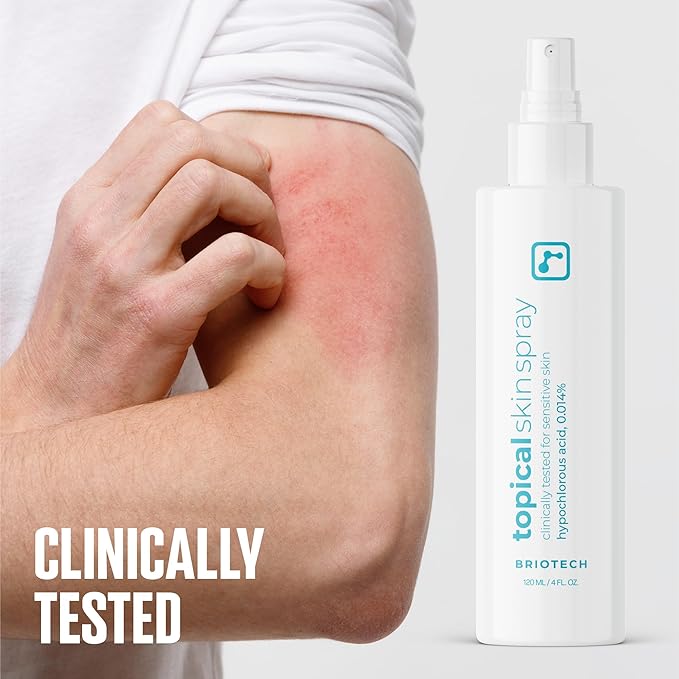 BRIOTECH Topical Skin Spray, Hypochlorous Acid Spray for Body & Face, Eyelid Cleanser, HOCl Facial Mist, Support Against Irritation, Calm Redness, Soothe Foot & Scalp, 128 fl oz (4 Pack)