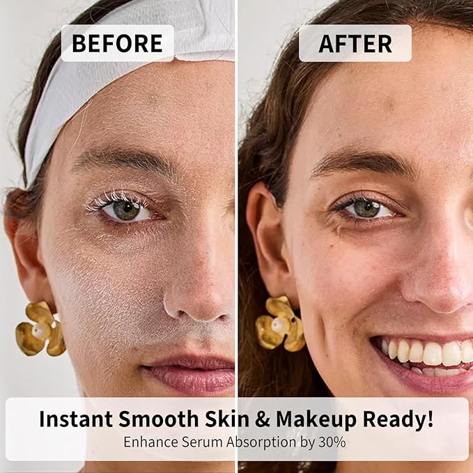 Face Razors for Women, Dermaplane Razor for Women Face, Eyebrow Razor, Facial Razors, Dermaplaning Tool, Reusable Metal Handle with 8 Microblades for Sensitive Skin, Peach Fuzz Remover, Pink