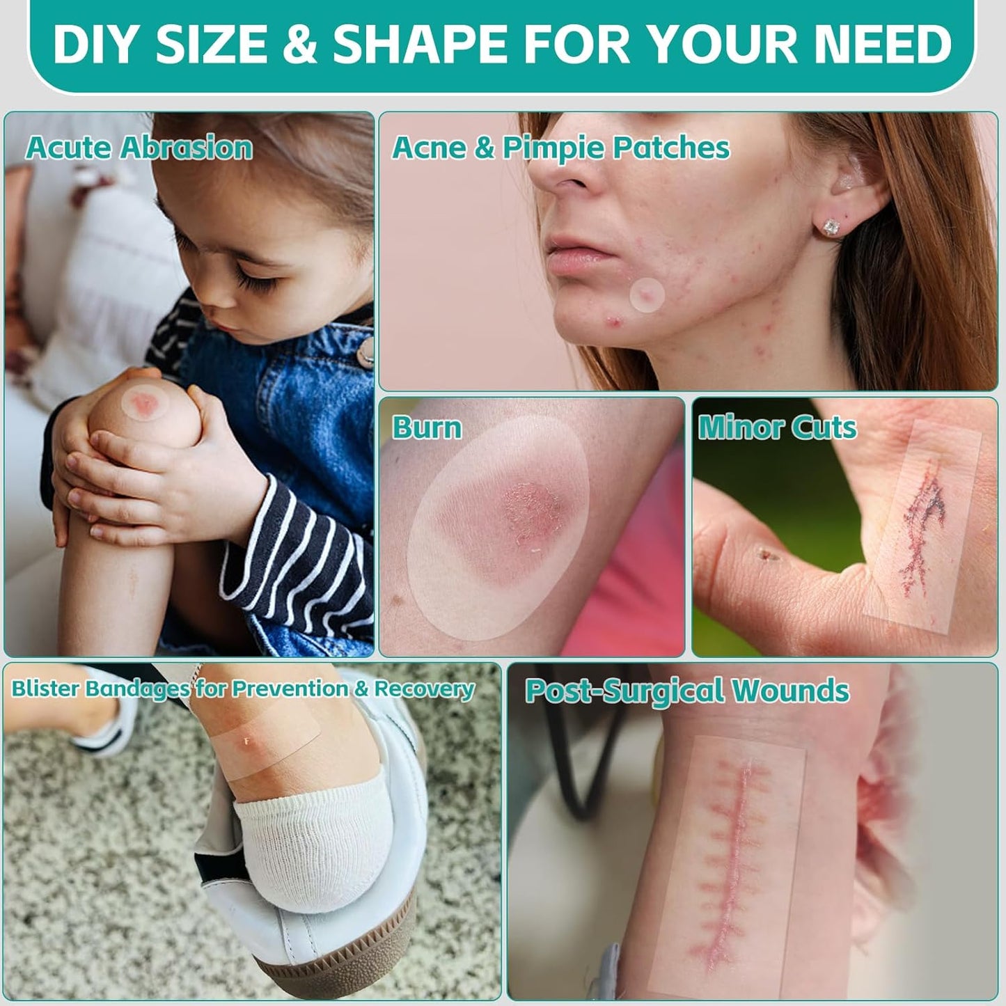 Upadated Hydrocolloid Bandages,2in*16ft Hydrocolloid Roll for Wound Care,Medical-Grade Hydrocolloid Patch Bandages with Self-Adhesive, Flexible & Waterproof DIY Size & Shape (2in*16ft)