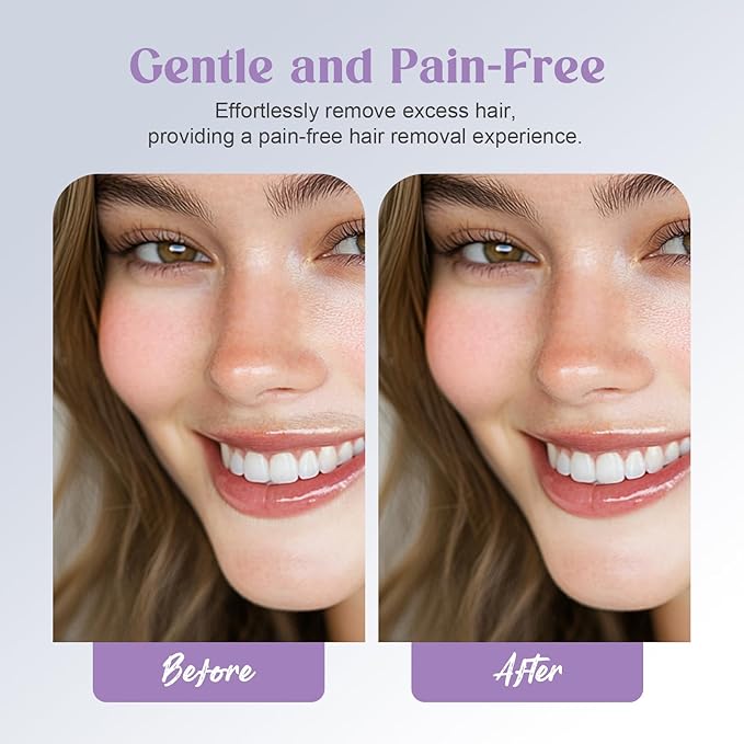 Battery Powered Facial Hair Remover for Women Lips, Chin, Neck, and Cheeks - Gentle and Pain with 2-pc Replacement Heads (Battery is not Included)