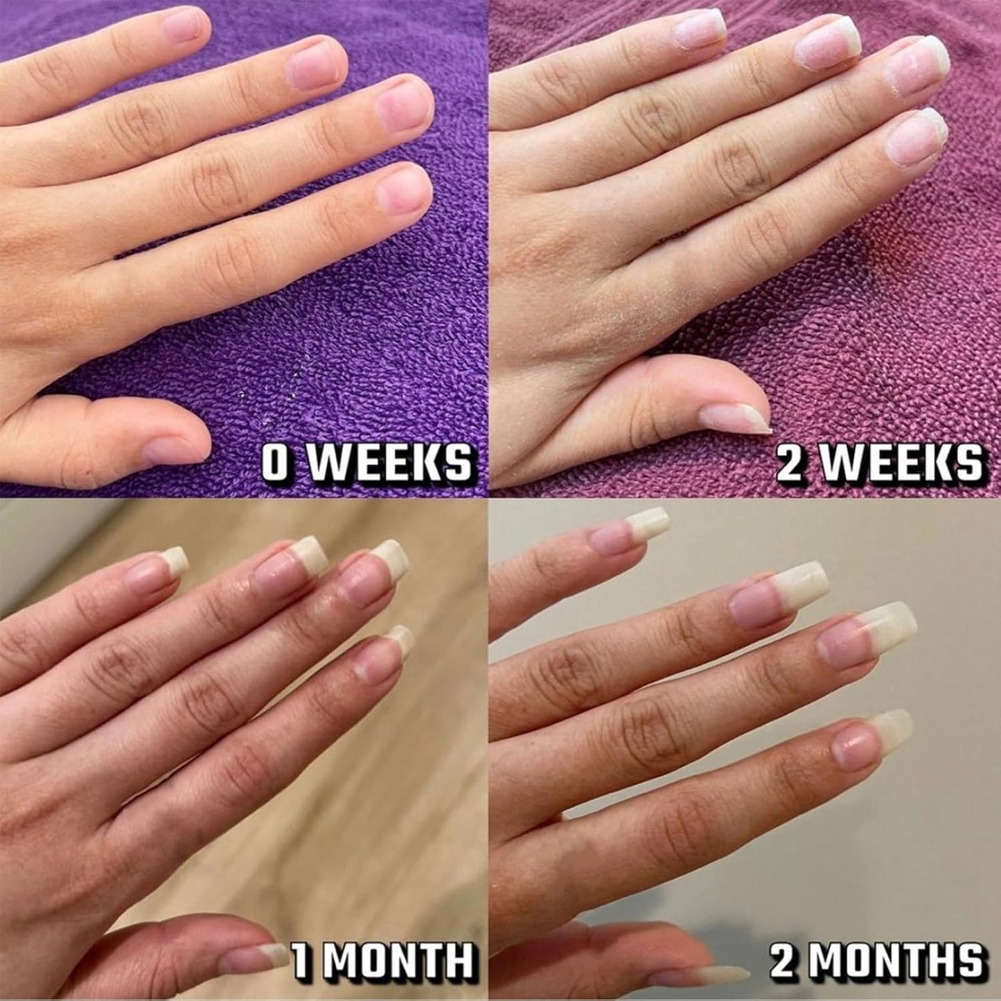 Merluna Nail 𝐆𝐫𝐨𝐰𝐭𝐡 Pen, Radiant Nail 𝐆𝐫𝐨𝐰𝐭𝐡 Oil Pens, Cuticle Oil for Nails, Nail 𝐍𝐮𝐭𝐫𝐢𝐞𝐧𝐭 Oil Pen for Moisturize Strengthen 𝐁𝐫𝐢𝐠𝐡𝐭𝐞𝐧 Nails Care (5pcs, 2ml)