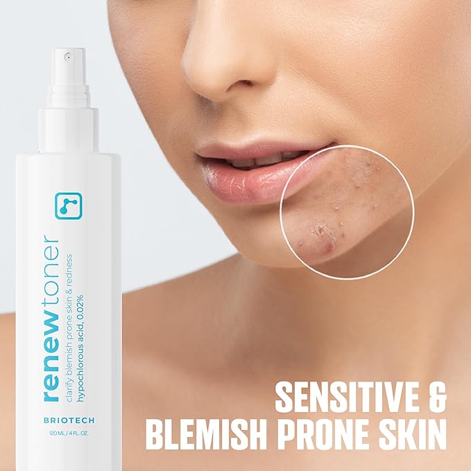BRIOTECH Skin Renew Toner, Hypochlorous Acid Spray Topical Skin Spray for Face and Skin, Minimize Appearance of Blemishes, Soothing Mist for Redness & Bumps, 4 fl oz