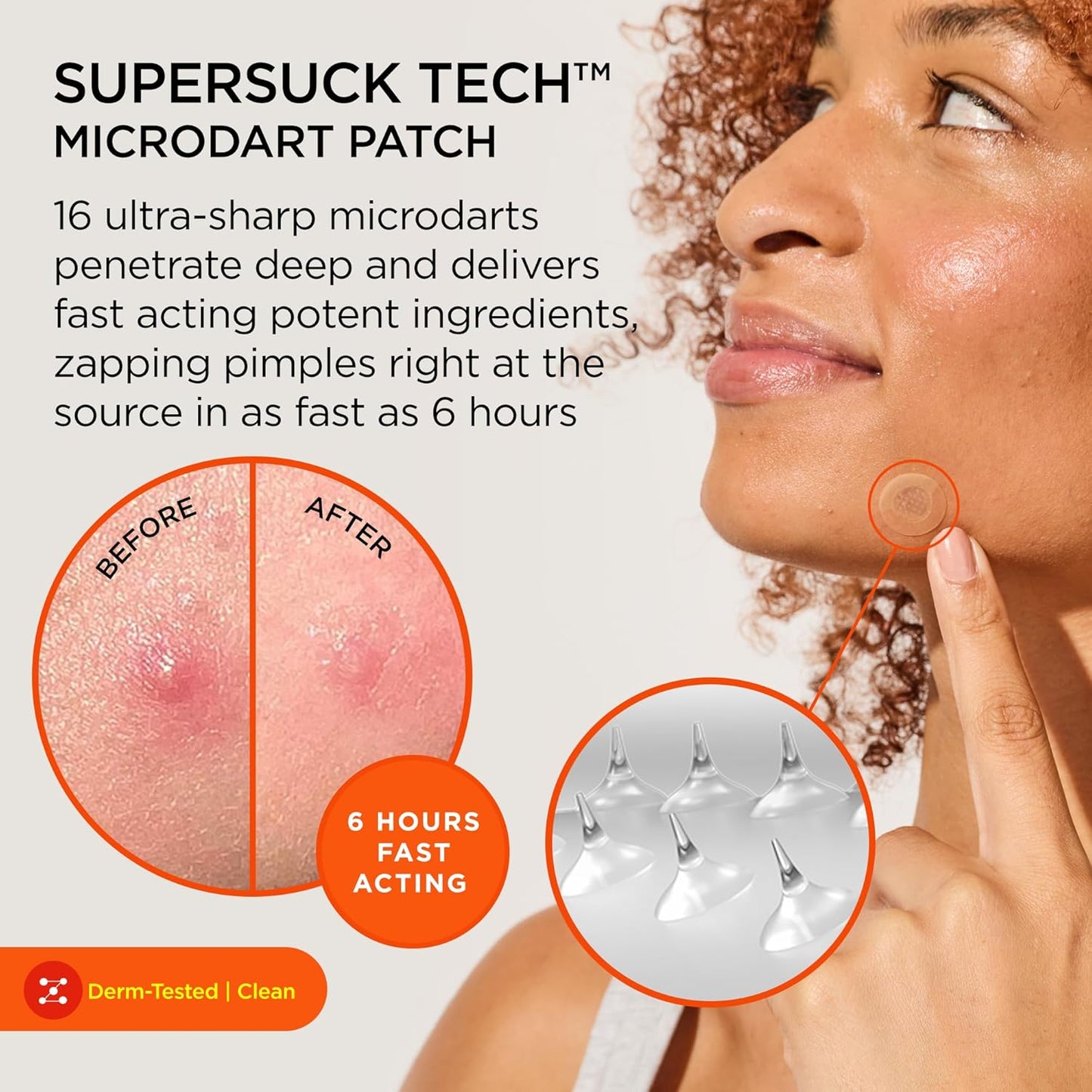 ZitSticka Killa Pimple Patches for Face - World's Most Potent Pimple Patch with Fast-Acting Microdarts - Starts Working within 6 Hours for Deep, Early-Stage Zits - Mini 16 Count