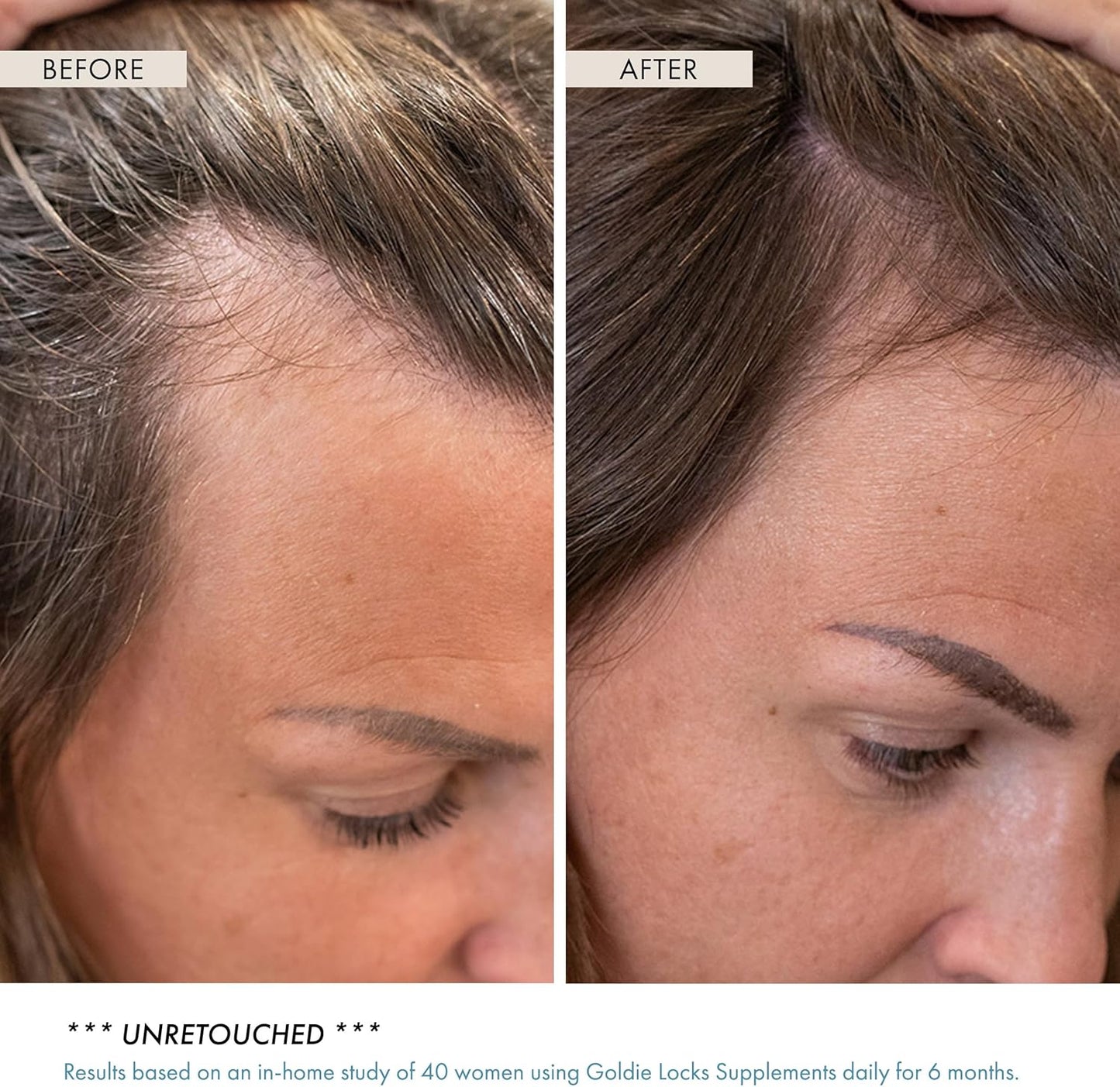 Goldie Locks Hair Growth Supplements Original Formula | Promotes Stronger & Healthier Hair | Vitamins That Enhance Hair, Skin, and Nails