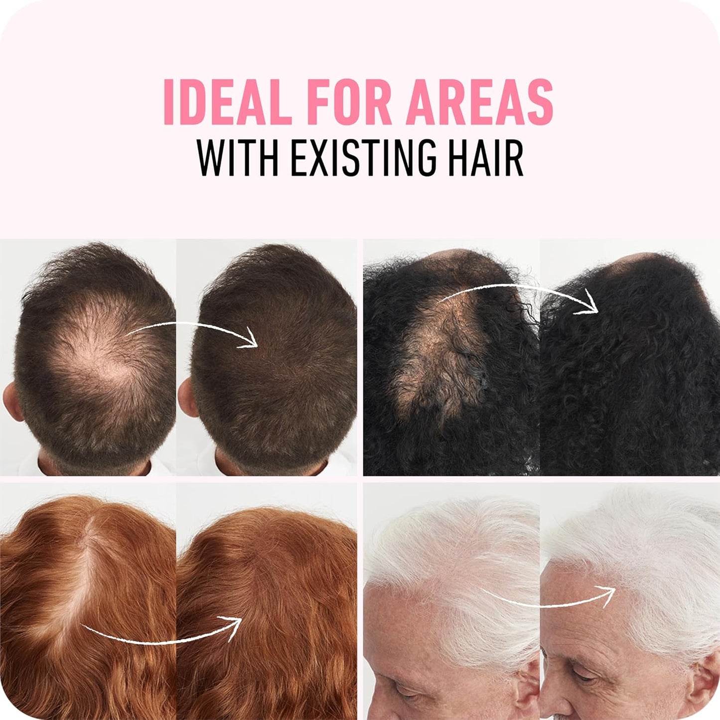 BOLDIFY Hair Fibers (12g) - Fill In Thinning and Fine Hair for an Instantly Fuller, Thicker Look - 14 Shades for Women & Men - Dark Brown