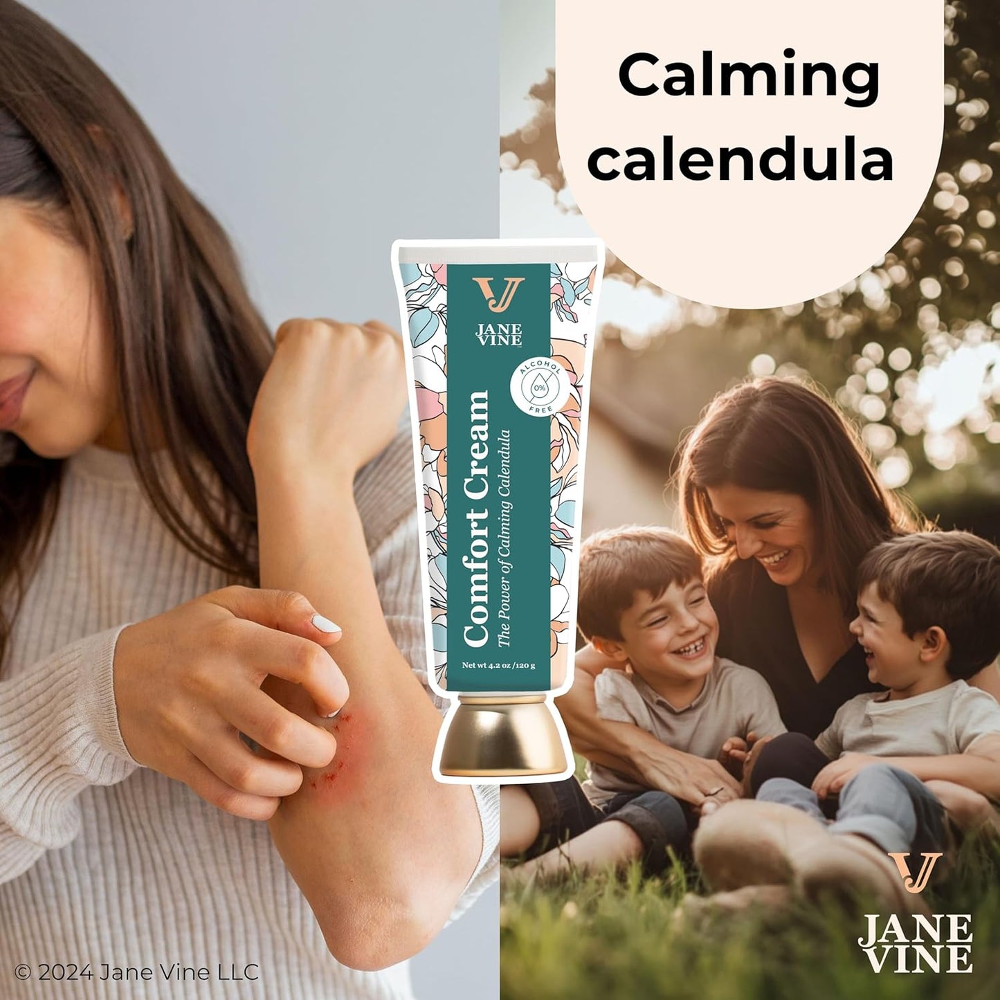 Calendula Cream – Radiation Relief Cream and Sunburn Relief for Itchy or Sun-Exposed Skin – With Aloe, Jojoba, and Dandelion – Alcohol Free & Unscented Calendula Ointment – 4.2 oz