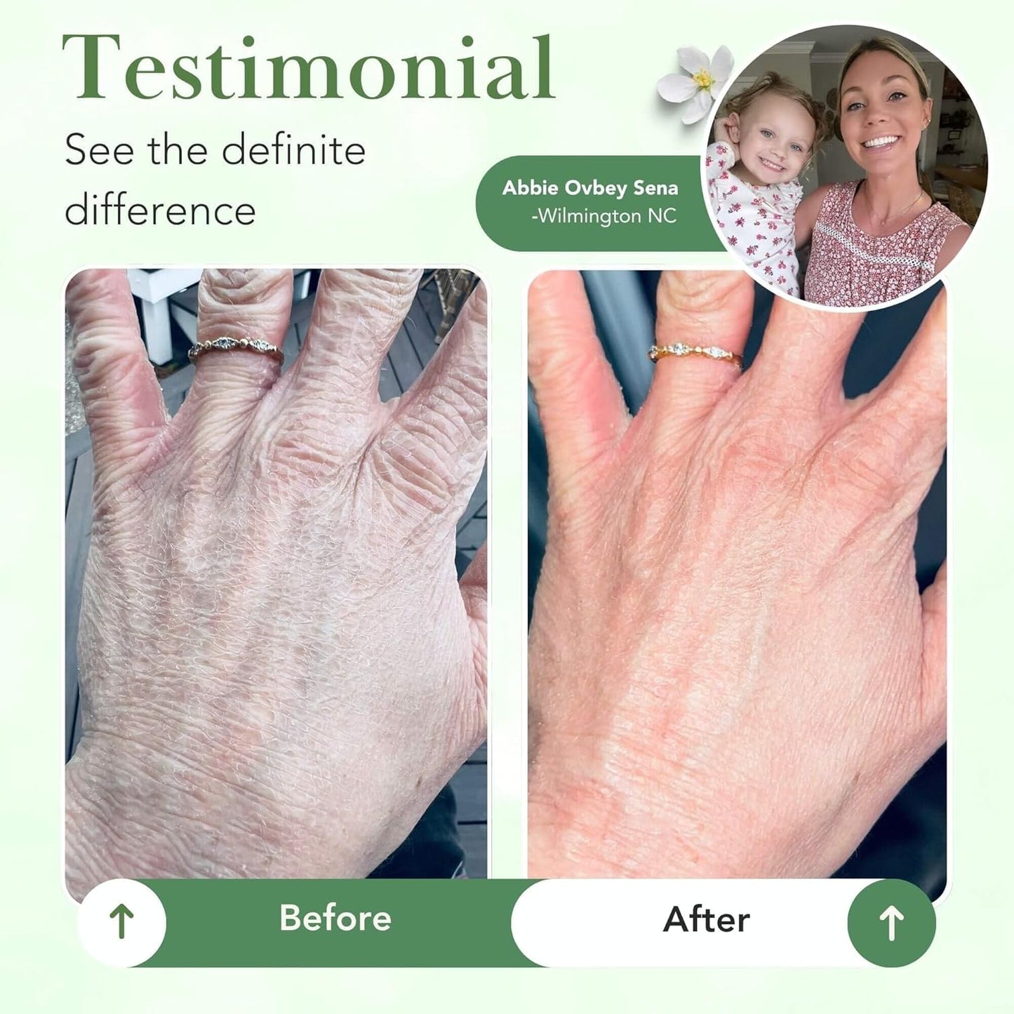 Theraplex Skin Barrier Balm- Barrier Repair Moisturizer Cream Body Balm Dry, Sensitive Skin - No Parabens or Preservatives, Noncomedogenic and Hypoallergenic - Dermatologist Recommended - 6 Oz