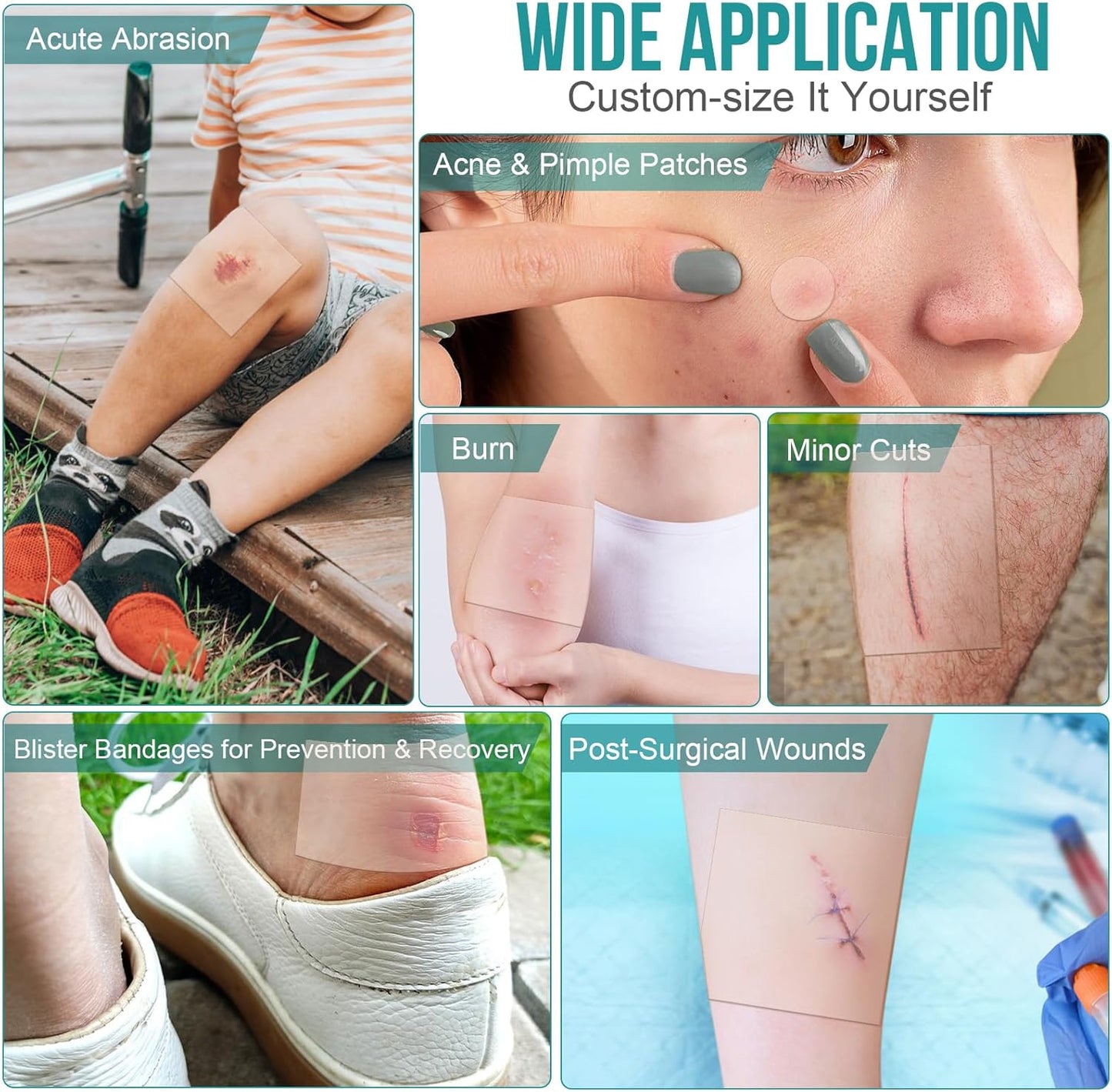 40 Pack Hydrocolloid Wound Dressing 4" x 4", Hydrocolloid Patch Bandages with Self-Adhesive, Bed Sore Bandages, Highly Absorbent for Burn, Blister, Acne Care, Sterile and Waterproof